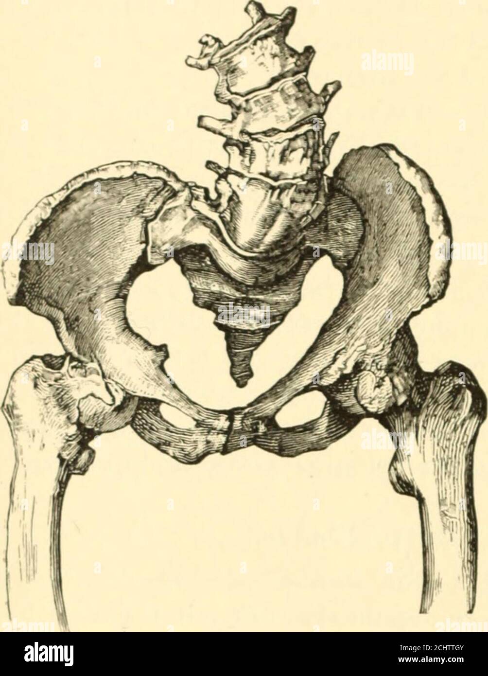 . The science and art of midwifery . ard. Theoblique diameter of this side is greater, hut the distance between thesacrum and t he acetabulum (distantia sacro-COtyhidea) is much shorterthan (ill the uncontracted side. The plane of the inlet is obliquelycordiform, being contracted upon the side of the lumbar scoliosis andexpanded on the other. Exactly the reverse conditions obtain at thepelvic outlet.* The conjugata vera is notably shortened by the pro-truding promontory. The antero-posterior diameter of the outlet,although contracted, still far surpasses the conjugata vera in Length.Other and Stock Photo