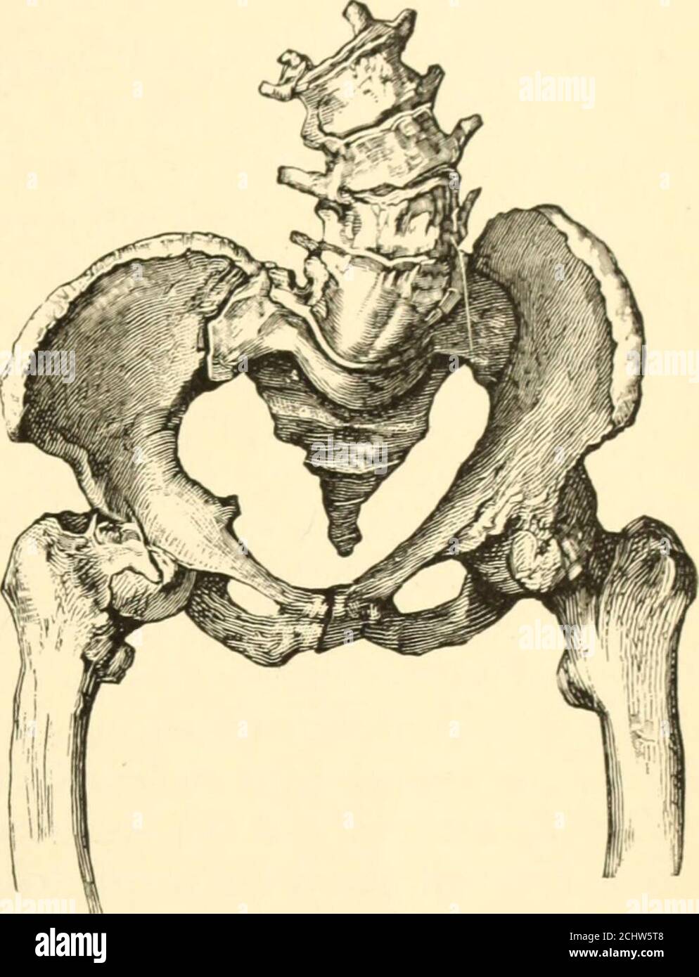 . The science and art of midwifery . lted backward, either the conjugata vera is increased or the previousrachitic antero-posterior narrowing is greatly diminished. In themovement of the sacrum upon its transverse axis the lower extremityis thrown forward, and the conjugate of the outlet is thereby reduced.Kyphosis, occurring at the beginning of rickets, diminishes the distancebetween the tuberosities of the ischia, but has little effect upon theinferior transverse diameter after the rachitic changes have once beenaccomplished. Influence of the Contracted Pelvis upon Pregnancy and Labor. The i Stock Photo