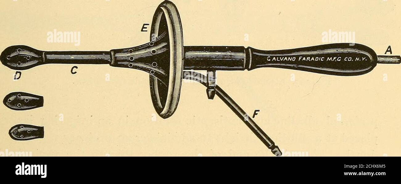 . The treatment of disease by electric currents : a hand-book of plain instructions for the general practitioner . the expirationof three months, the patient declared herself relieved of thetrouble. {Gardner^ Vaginitis.—Simple acute and sub-acute inflammation of thevaginal mucous membrane may be satisfactorily treated byvaginal- bipolar faradic sedation combined with some of thesimpler accessory medication. The sedative coil currentshould be applied according to the directions given for thetreatment of other acute pelvic inflammations (see Index) andrepeated p. r. n. TREATMENT OF MISCELLANEOUS Stock Photo