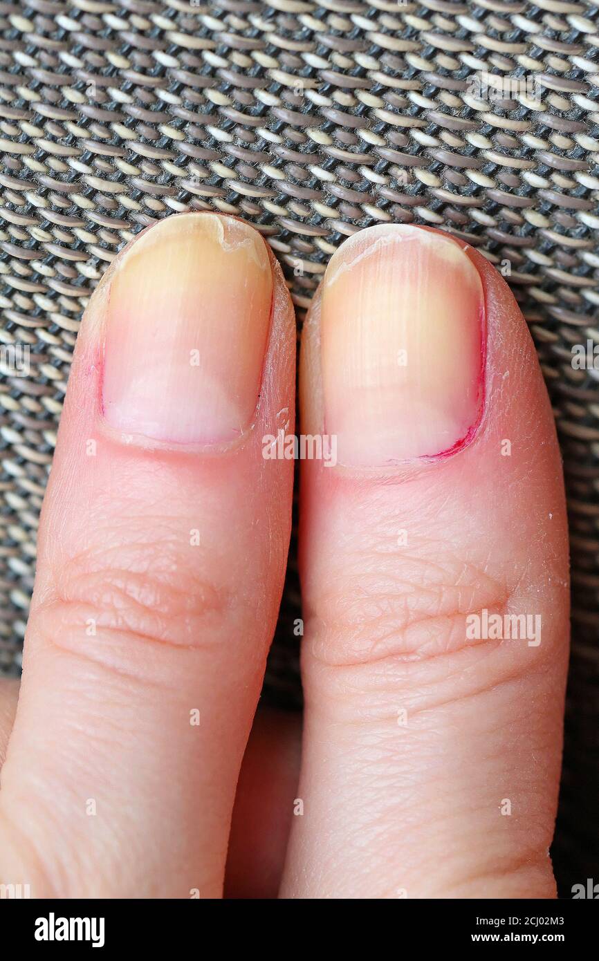 Dirty fingernails hires stock photography and images Alamy