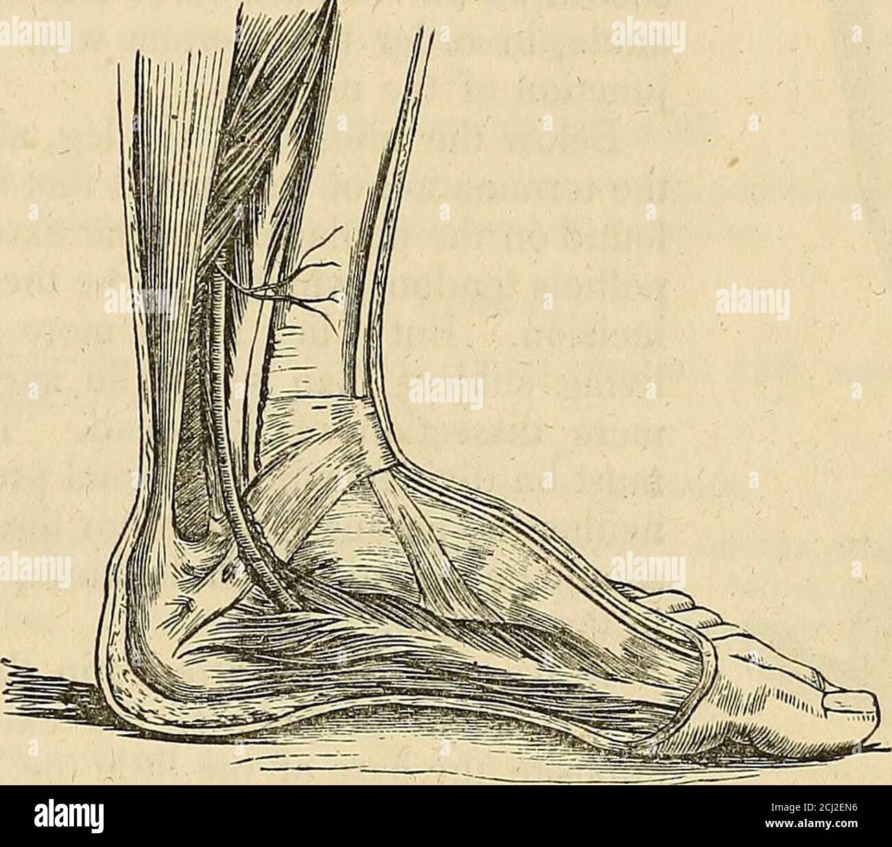 Peroneal artery hi-res stock photography and images - Alamy