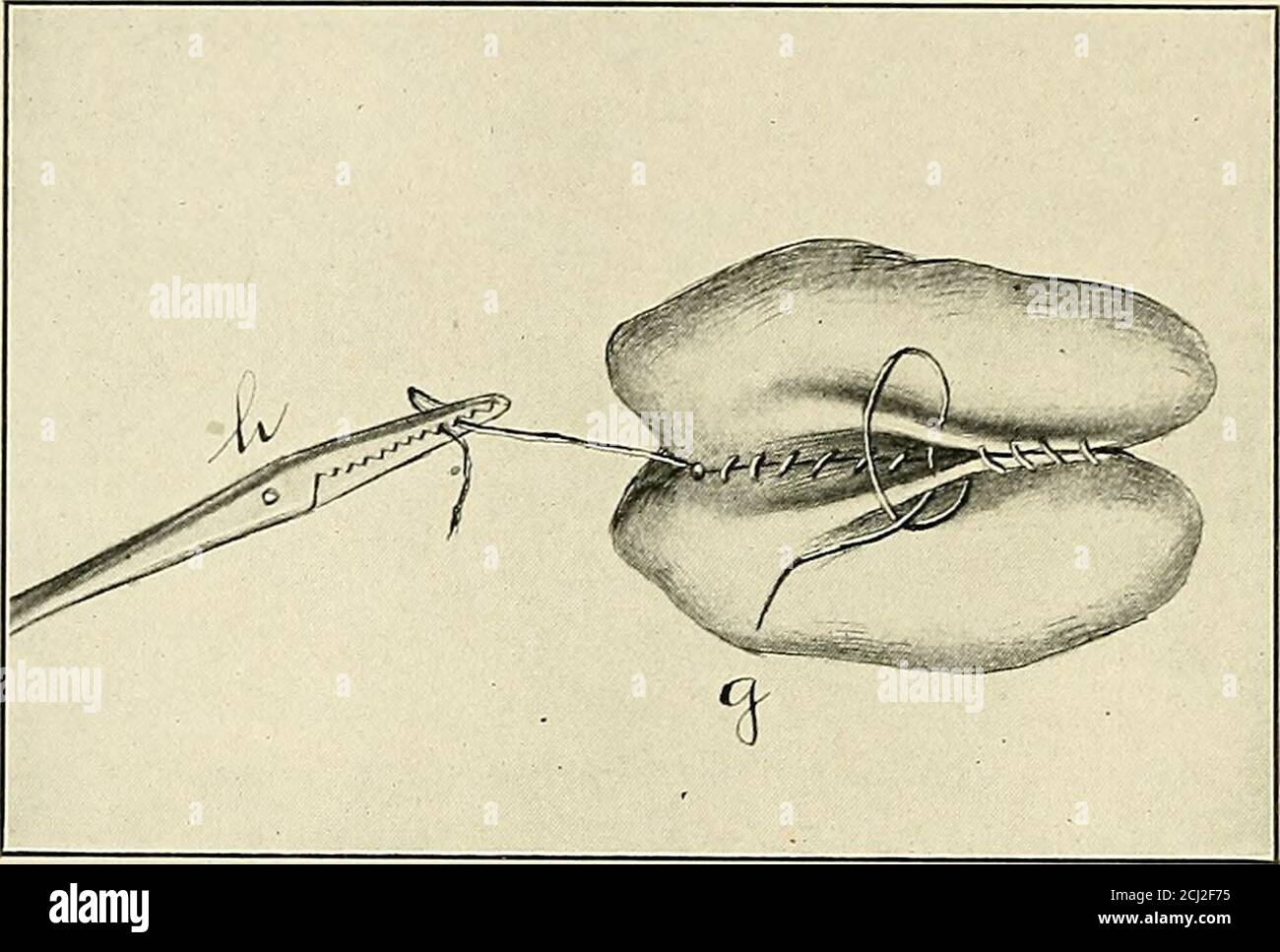 Gastro diagram hires stock photography and images Alamy