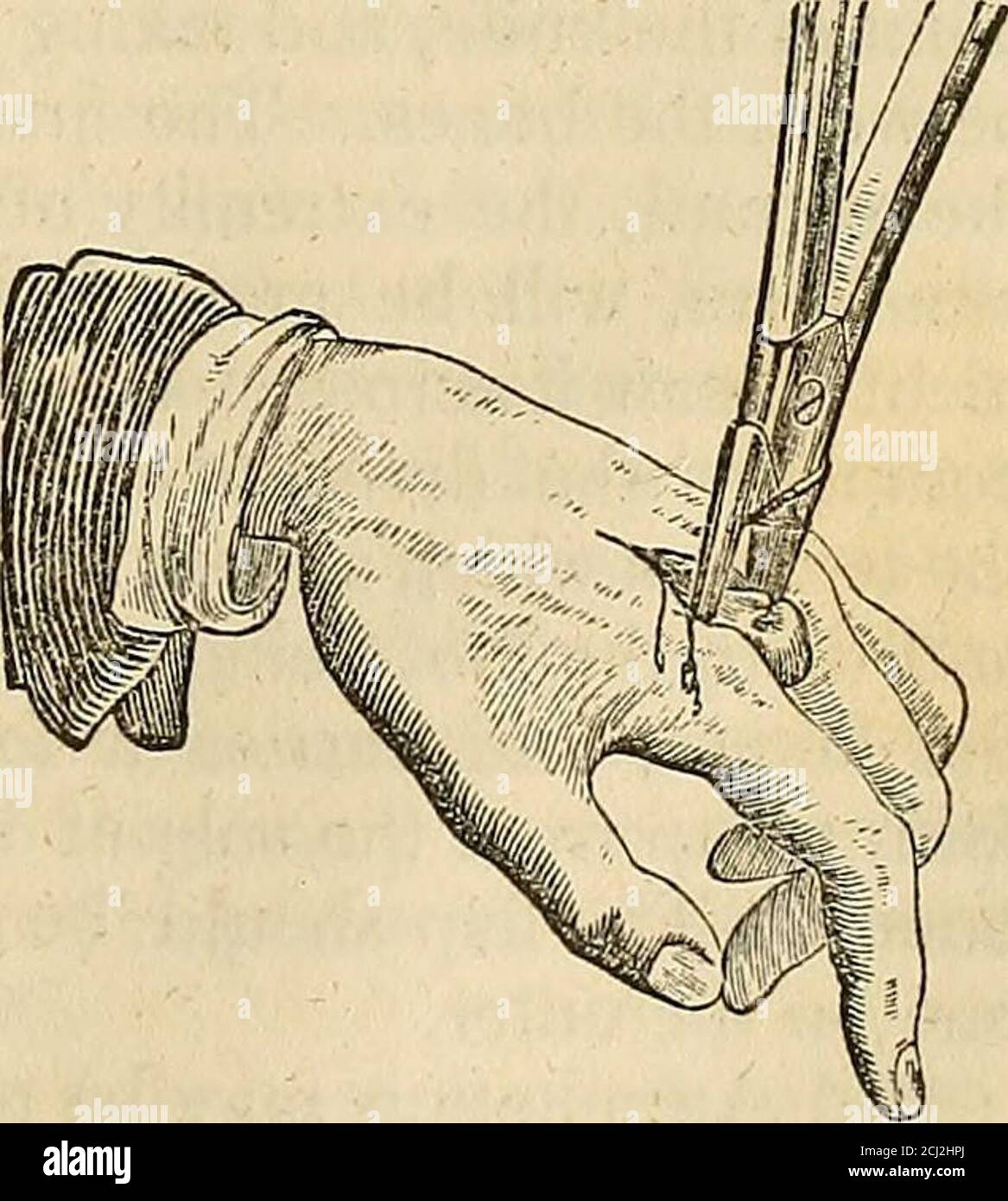 . The principles and practice of modern surgery . ded, first on the