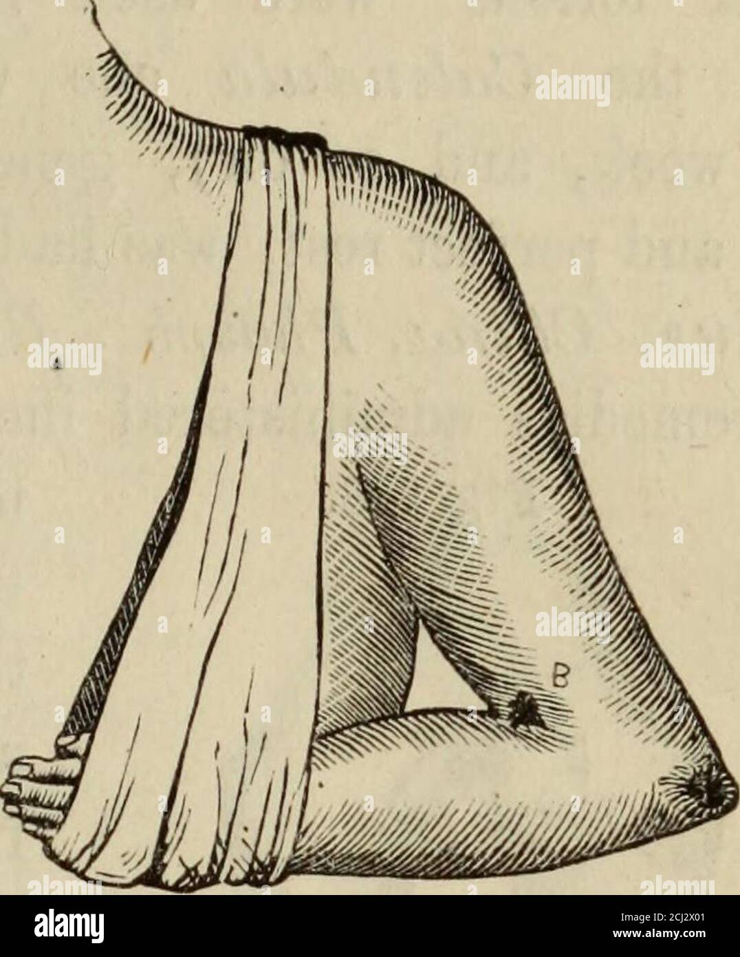 The Science And Art Of Surgery Embracing Minor And Operative Surgery Comp From Standard Allopathic Authorities And Adapted To Homoeopathic Therapeutics With A General History Of Surgery From The Earliest Periods