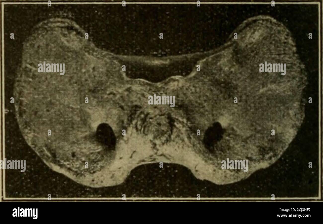 . Archiv furgeschichte . Fig. 7. Bos primigenius. Fiff. 8. Bison
