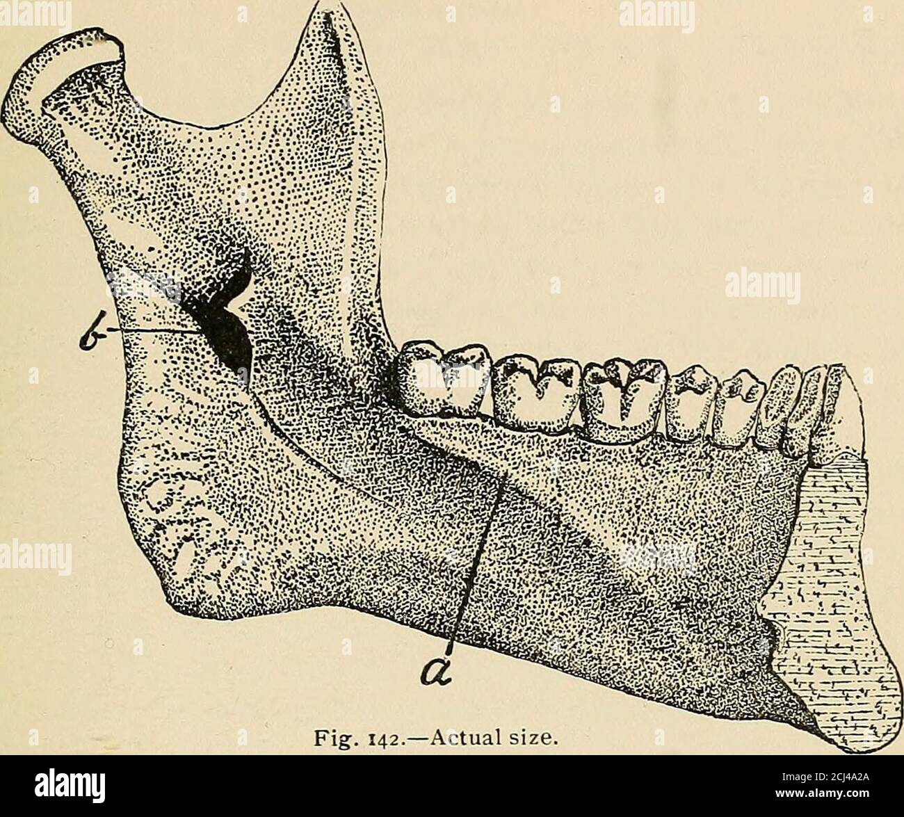. Descriptive anatomy of the human teeth . eth, constituting the condition known astongue-tied. This is generally corrected by the muscularefforts of the tongue, which stretch the membrane sufficientlyto accommodate its motions. 210. On the lingual side, in the upper jaw, the gums(Fig. 127) are usually of greater extent and thicker. Theycover the entire roof of the mouth, to the conjunction of thehard and soft palate, as a hard dense layer. In the anteriorportion, a series of irregular ridges, known as the rugae, radi-ate from the median line toward both sides, stopping short ofthe gingivae. I Stock Photo