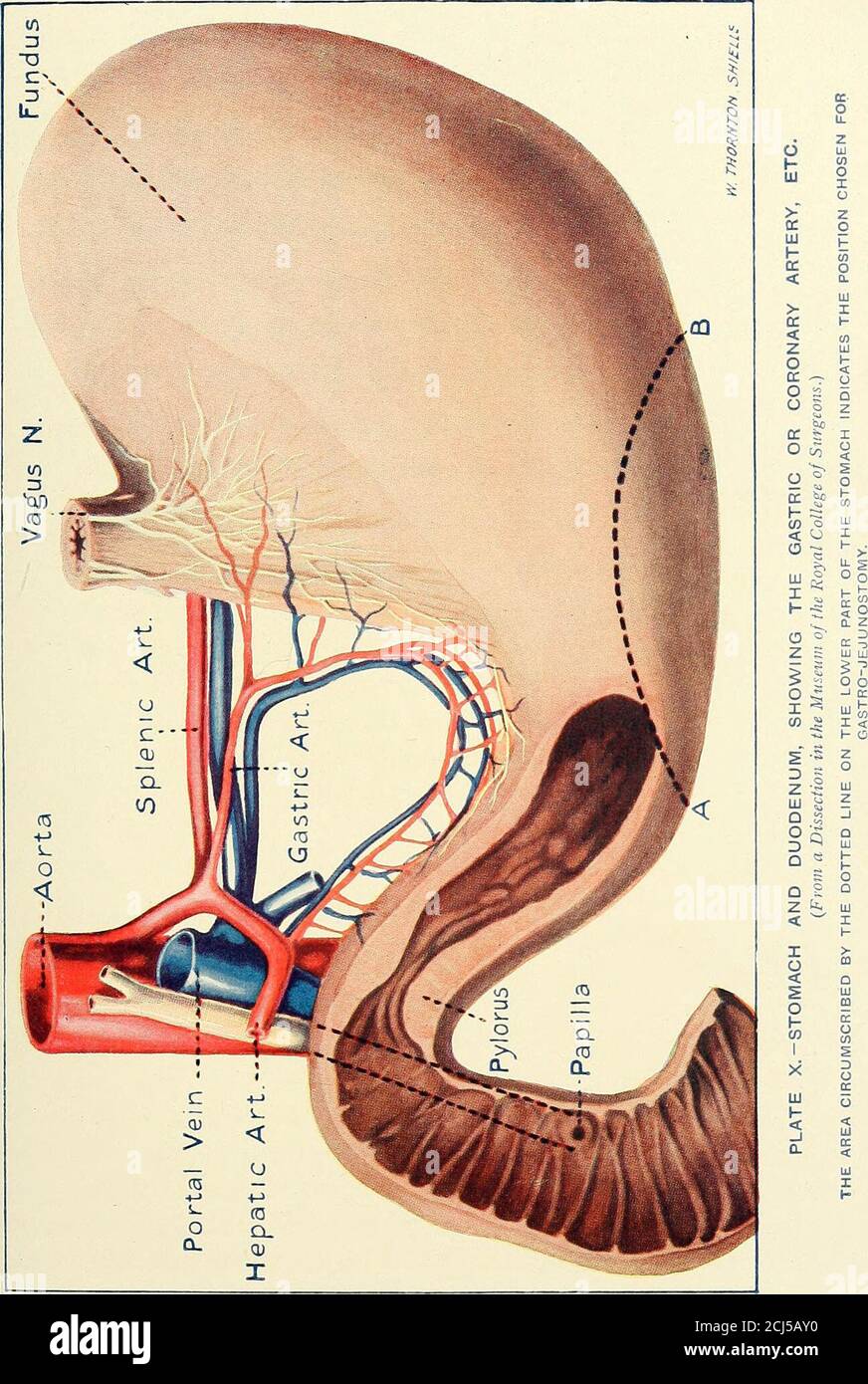 A Manual Of Operative Surgery Terzi S M Fig 49 Position And Relations Of The Stomach And Duodenum Showingalso Their Arterial Supply After Testut S Stomach P Pylorus D