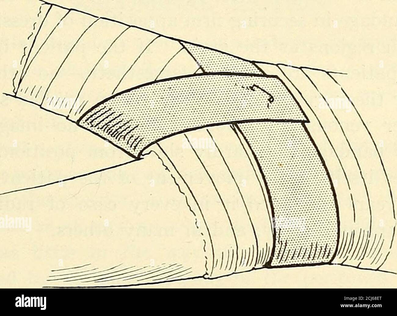 Groin wounds hires stock photography and images Alamy