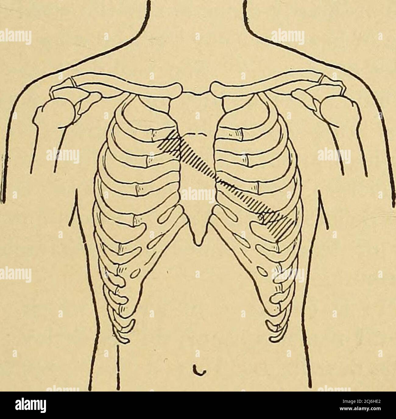 . Physical diagnosis . percussion, and uponthe condition of the pulmonary and peripheral circulation, asshown in the other symptoms and signs of the cases (dropsy, cough,etc.). (4) Intensity of Murmurs.—Sometimes murmurs are so loudthat they are audible to the patient himself or even at some dis-tance from the chest. In one case I was able to hear a murmureight feet from the patient. Such cases are rare and usually notserious, for the gravity of the lesion is not at all proportional to AUSCULTATION OF THE HEART. 191 the loudness of the murmur; indeed, other things being equal,loud murmurs are Stock Photo