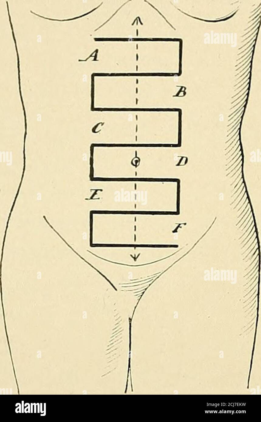. American practice of surgery ; a complete system of the science and ...