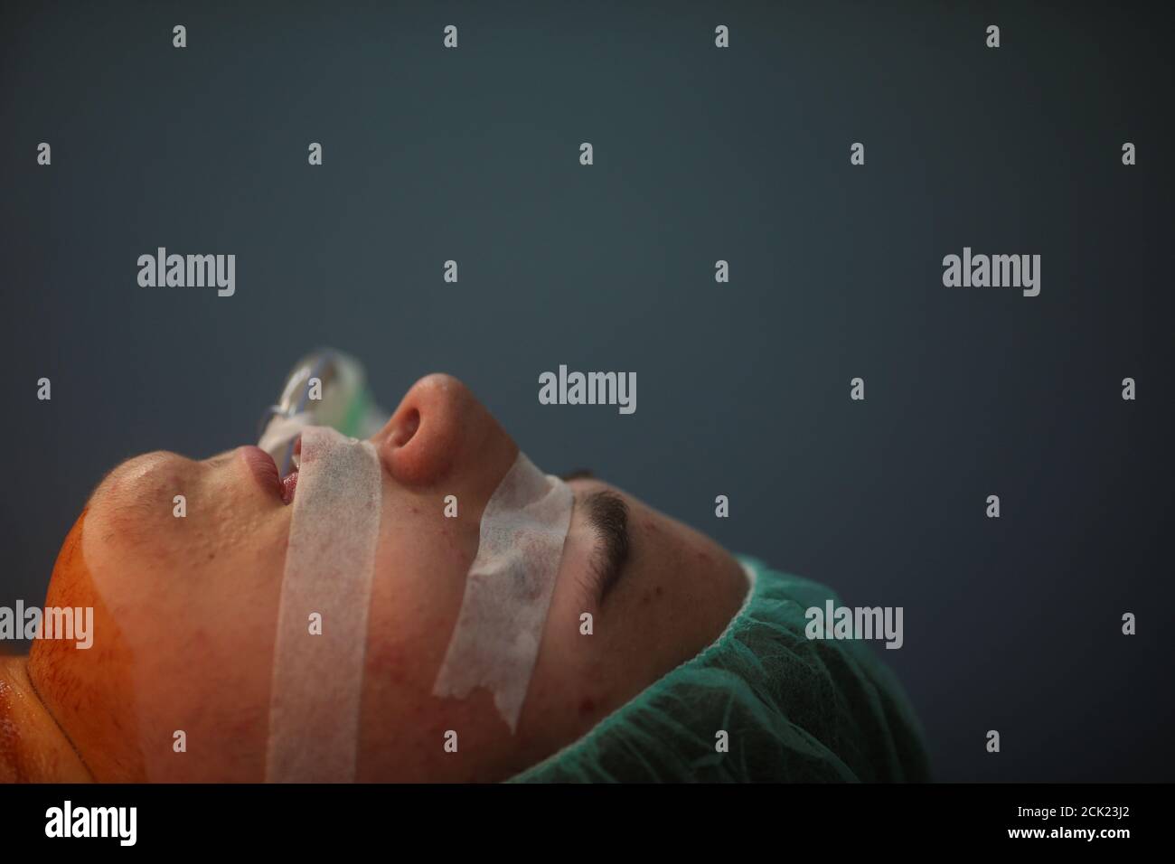Transgender teenager Gabriel Diaz de Tudanca, 18, undergoes a female to male chest reconstruction surgery in Madrid, Spain, October 26, 2016. REUTERS/Susana Vera SEARCH Transgender teenager Gabriel Diaz de Tudanca, 18, undergoes a female to male chest reconstruction surgery in Madrid, Spain, October 26, 2016. REUTERS/Susana Vera SEARCH