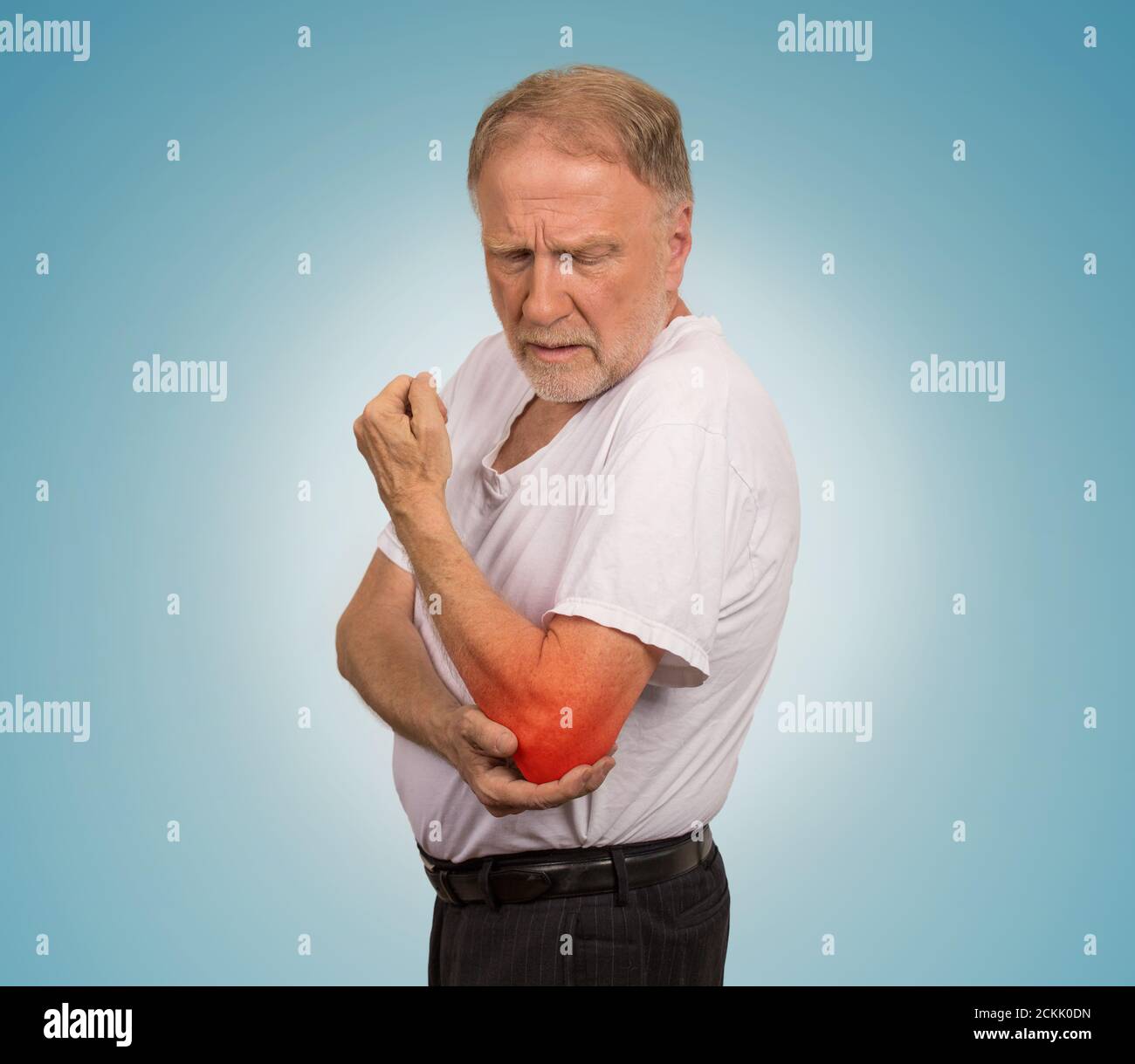 Elderly broken arm hi-res stock photography and images - Alamy