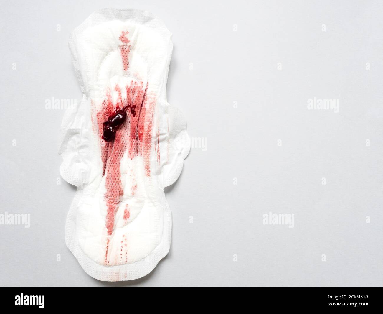 Symptom of endometriosis, menstrual blood with blood clots on a sanitary  pad Stock Photo - Alamy