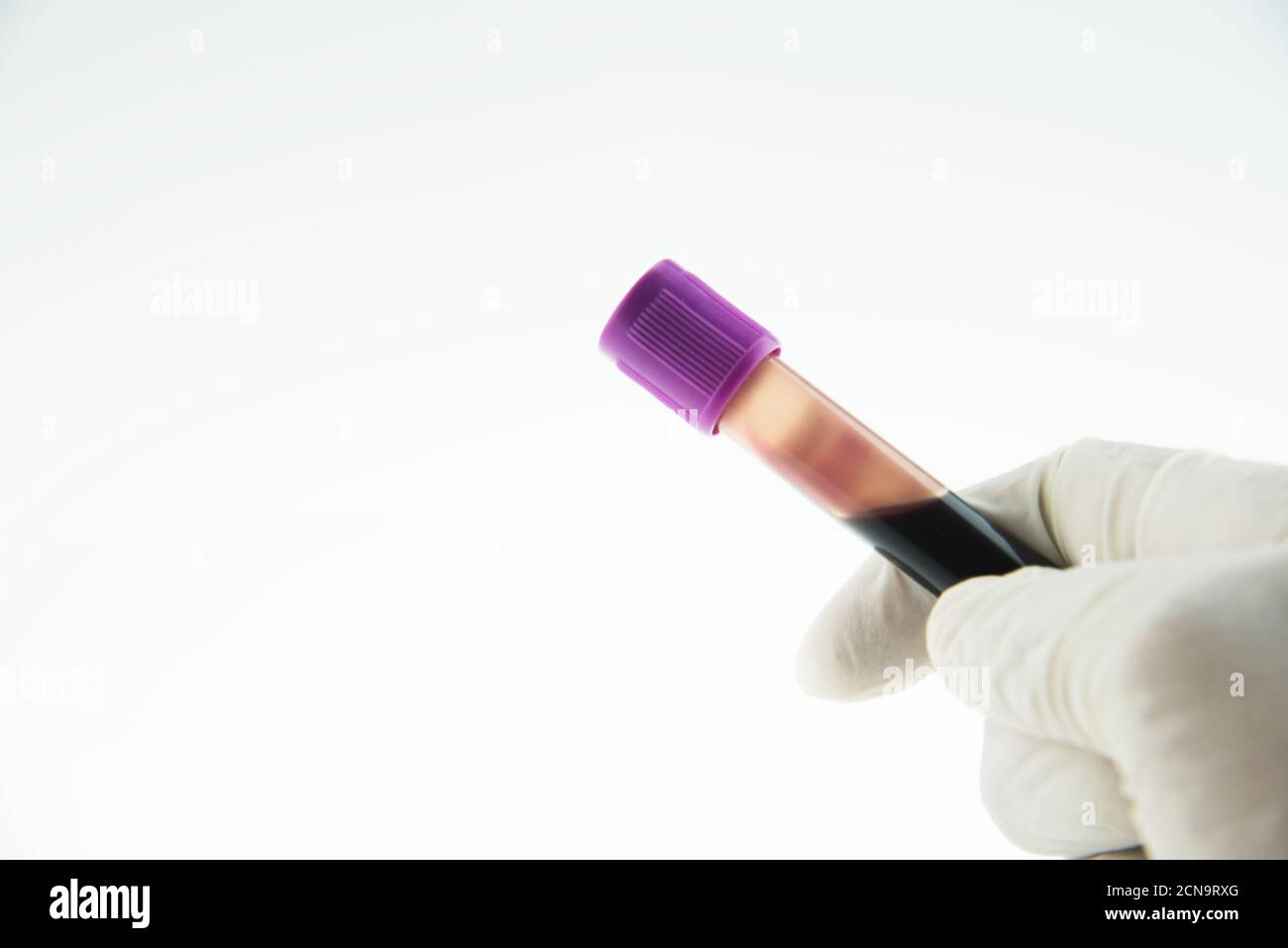 Vacutainer EDTA blood collection tubes. Stock Photo