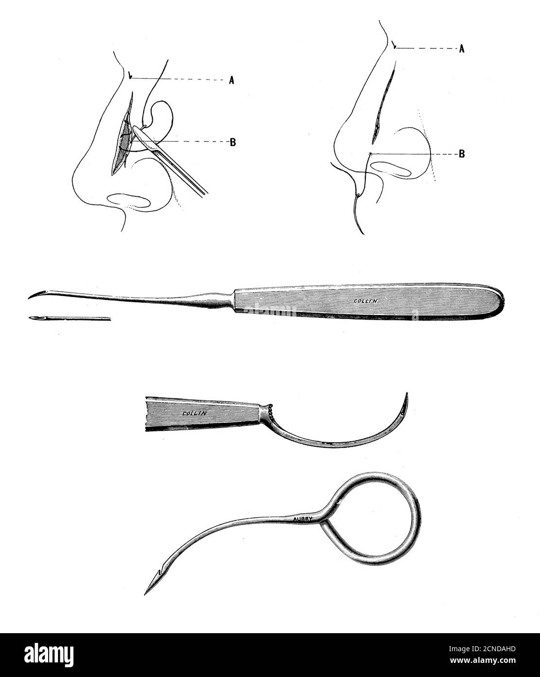 Healthcare and medicine: intracutaneous suture tools, vintage illustration Stock Photo