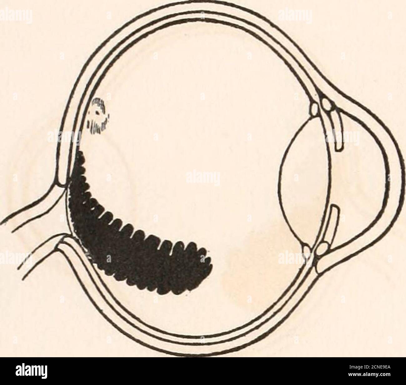 Pecten Eye . The fundus oculi of birds, especially as viewed by the ophthalmoscope ...