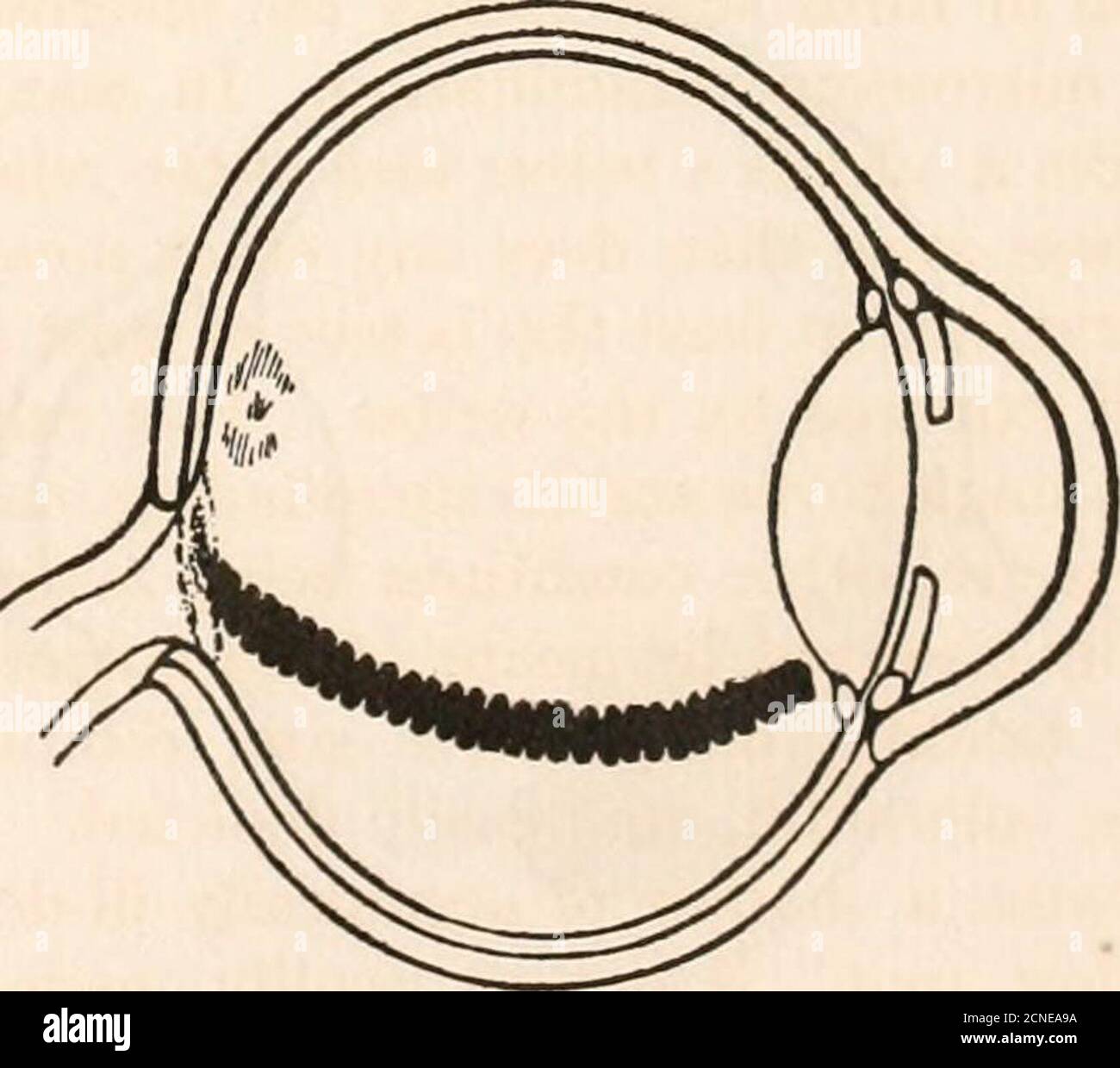 Pecten Eye . The fundus oculi of birds, especially as viewed by the ophthalmoscope ...