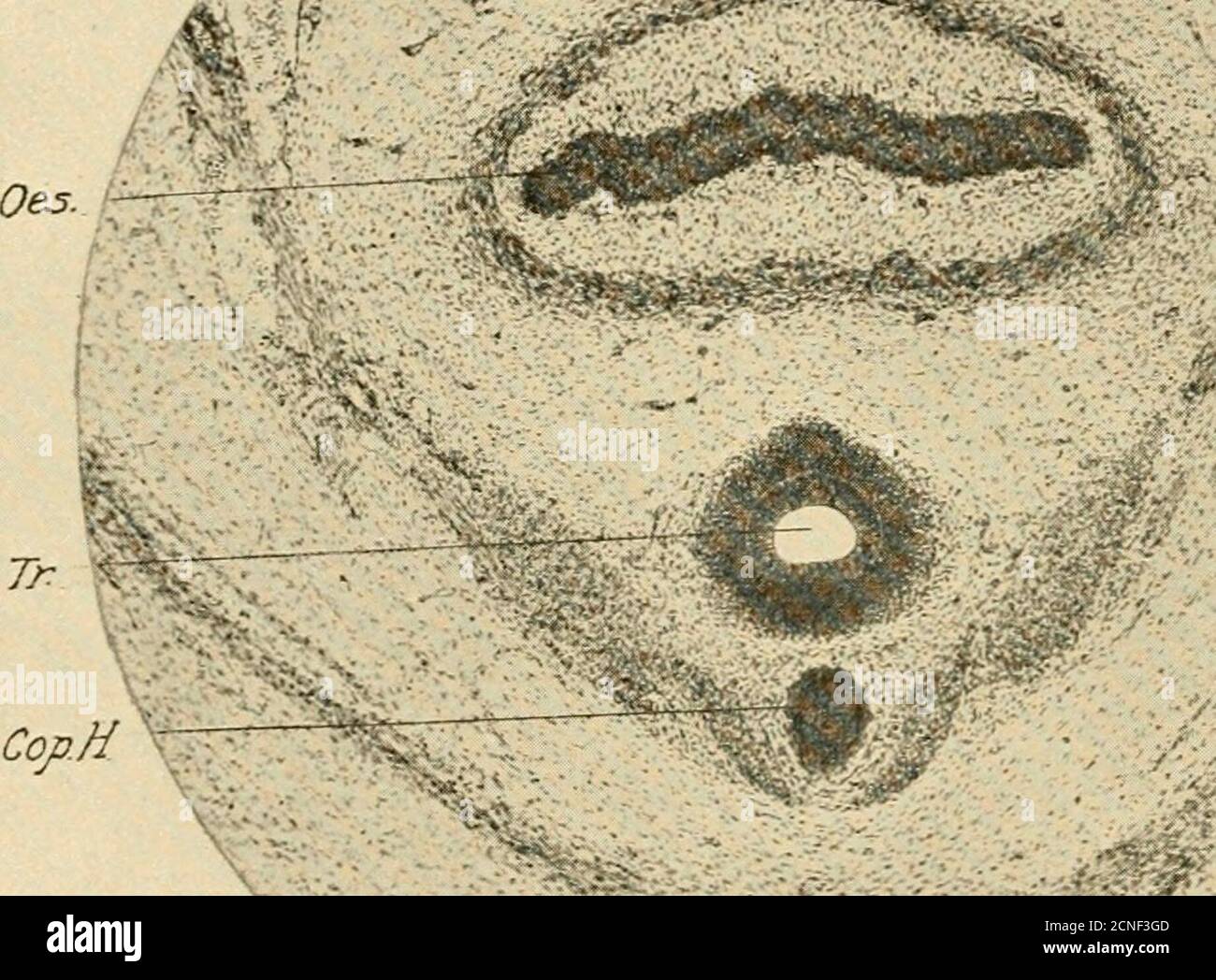Umbilical loop hi-res stock photography and images - Alamy