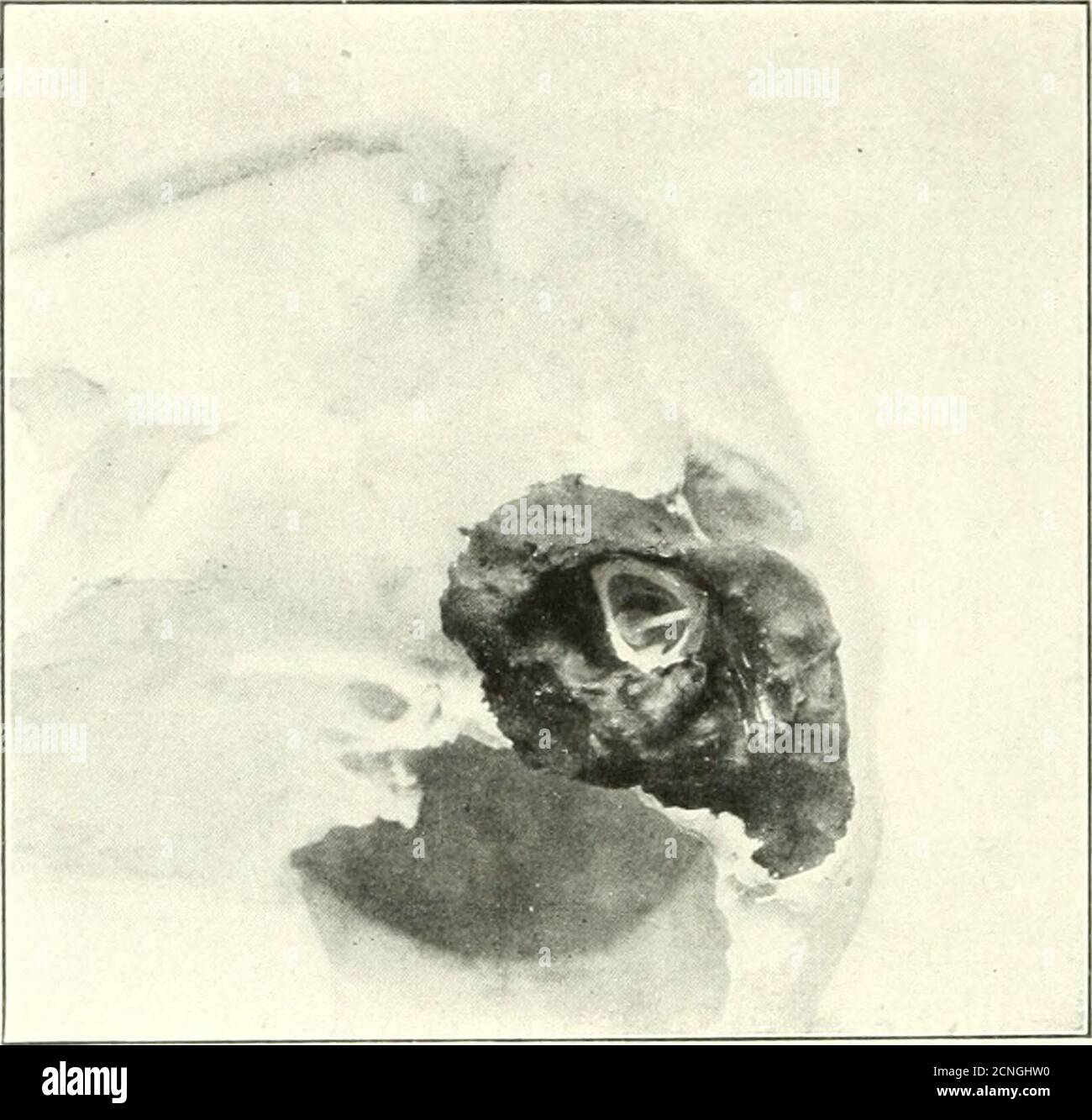The Bird Its Form And Function Bear Another Pair Of Bones Fig 85 Coluniella In Ear Of Snowy Owl Magnified 2 Diameters Extending Inward From Them Beneath The Skull To Thebroad The Bird Its Form And Function Bear Another Pair Of Bones Fig 85 Coluniella In Ear Of Snowy Owl Magnified 2 Diameters Extending Inward From Them Beneath The Skull To Thebroad