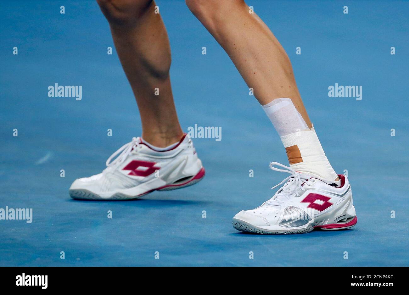 Poland's Agnieszka Radwanska wears a bandage on her leg during her third  round match against Puerto Rico's Monica Puig at the Australian Open tennis  tournament at Melbourne Park, Australia, January 22, 2016.
