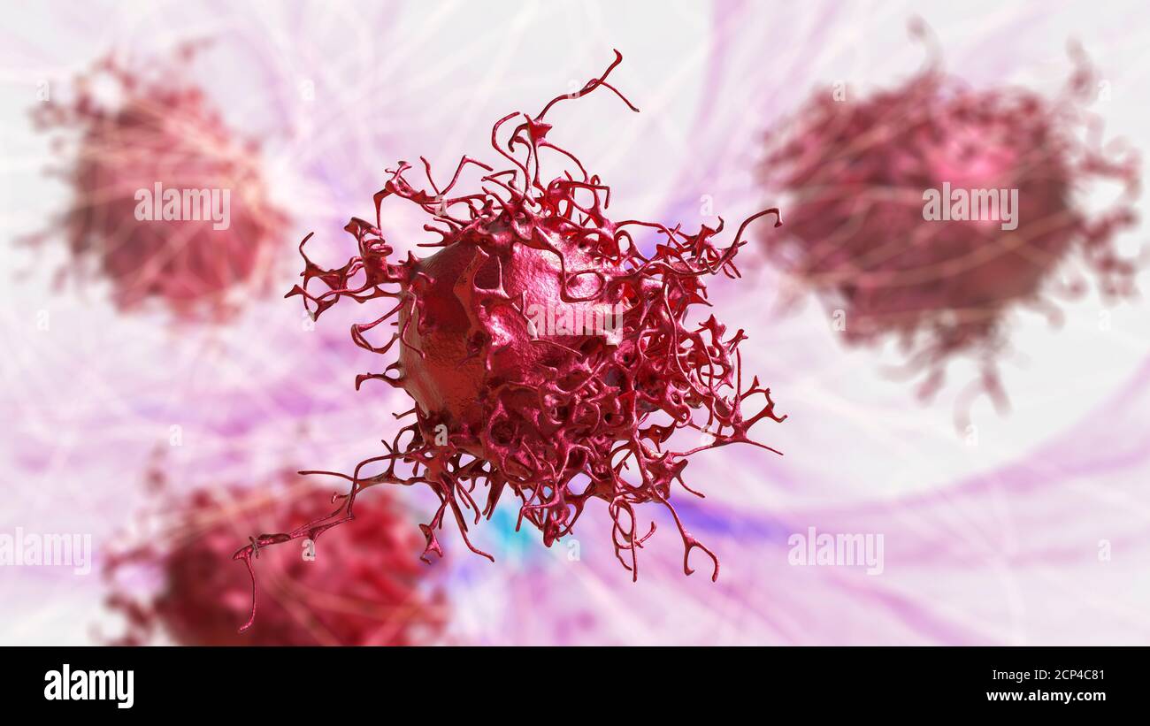 Cervical cancer cells, computer illustration Stock Photo - Alamy