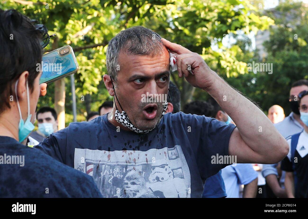 Anti Psg High Resolution Stock Photography And Images Alamy Anti Psg High Resolution Stock Photography And Images Alamy