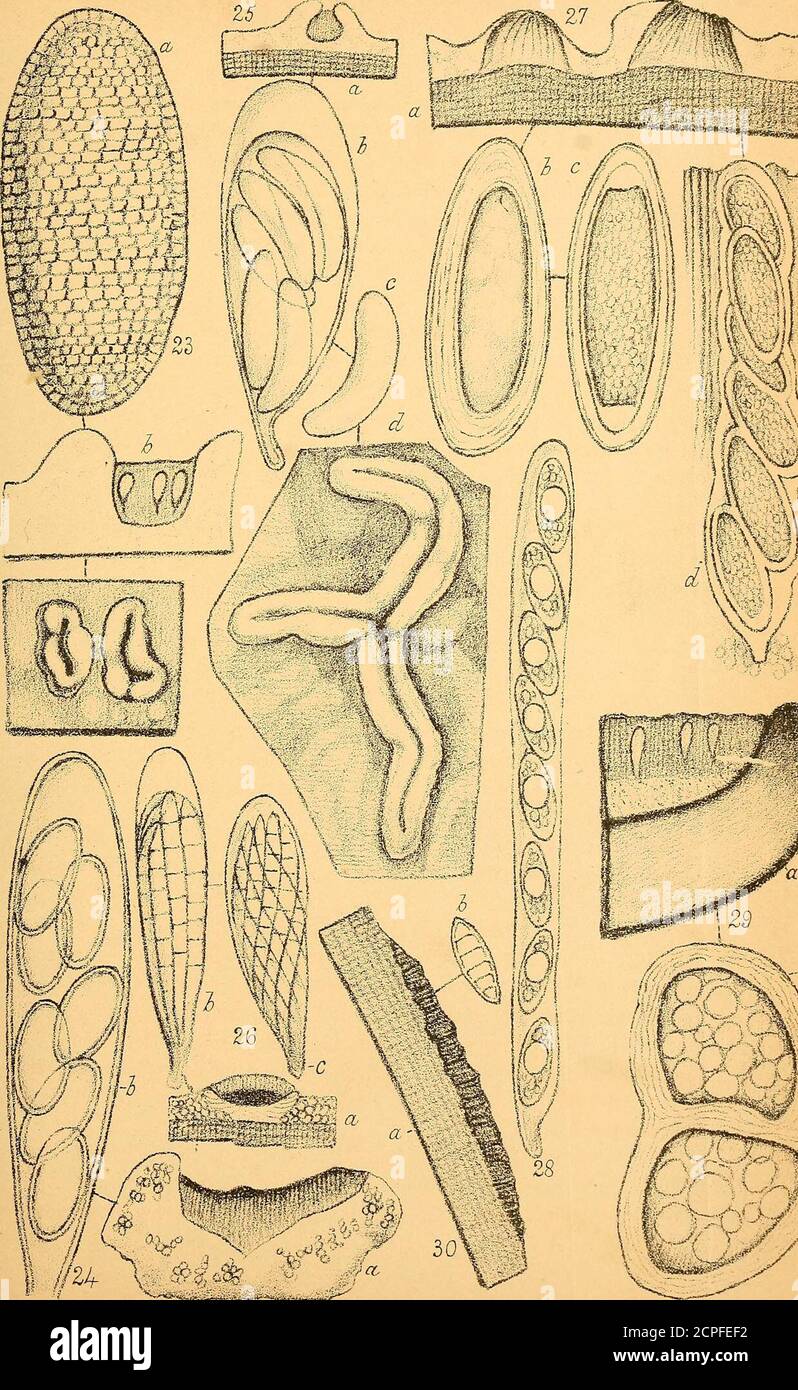 . Transactions and proceedings of the New Zealand Institute . a made-facta aduata atra minuta (diam. 0-2 mm.) hemisphaarica, excipulo dimidiato,ostiolo pallido minutissimo v. nullo, paraphysibus distinctis. Sporas inascis cylindraceis fusiformes incolores 3-7-septatae, longit. 0-02, crassit.0-005 mm. Ad arborum cortices. Obs.—Var. a. Thallus albescens, sporas 7-cellula3, cellulis mediomajoribus. 33. Verrucaria (Thelidium) suffusa, n. sp. Tballus cinereus tenuis effusus a linea fusca limitatus. Apotbeciaminuta (diam. 0-3 mm.) hemisphaerica thallo leviter obtecta, excipulo atrocrasso dimidiato, Stock Photo