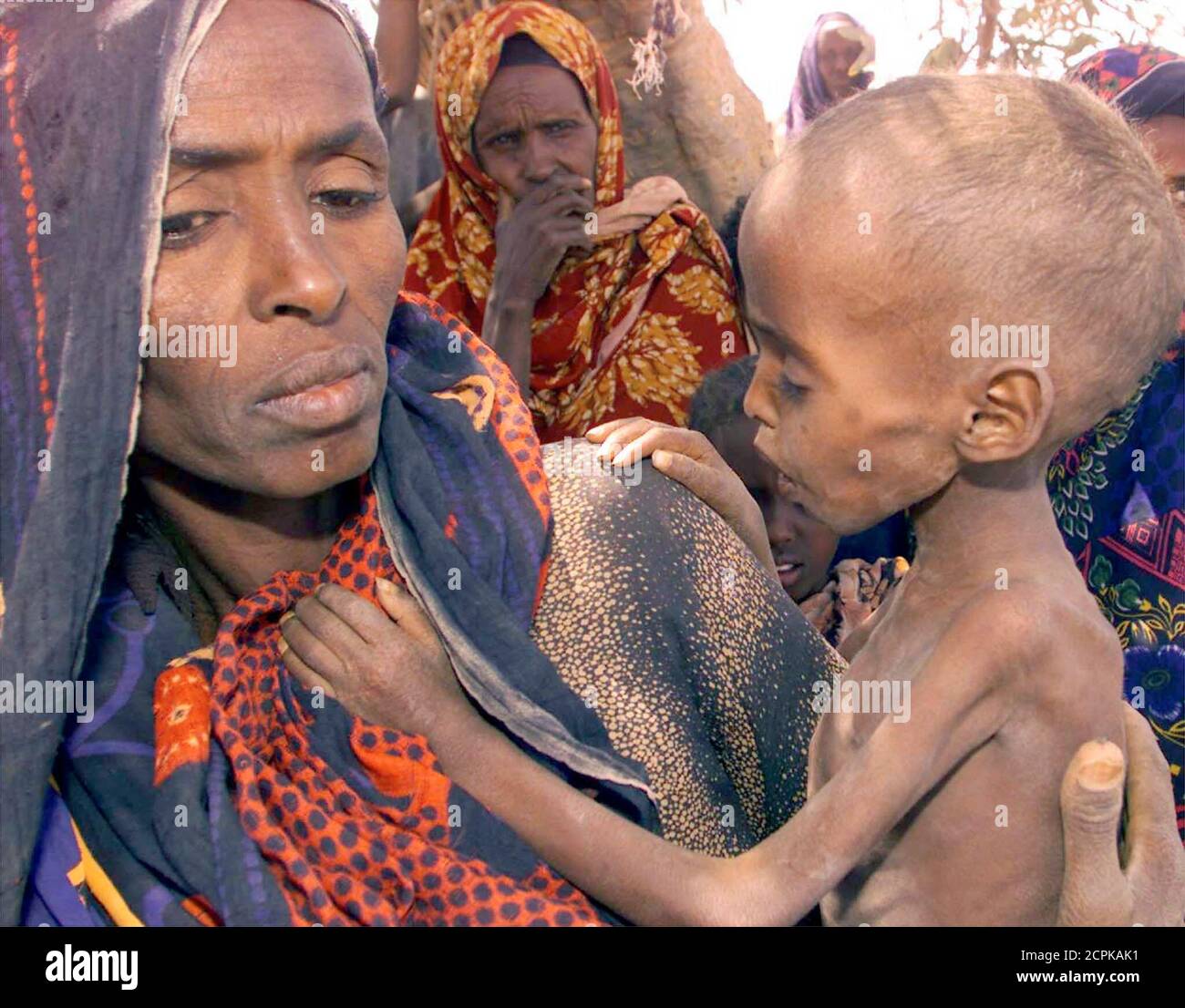 A woman holds malnourished child at a camp in the town of Danan, some six hundred kilometers South East of Addis Ababa on April 7. Eight children are dying every day from famine in Ethiopia's remote Ogaden region. Close to eight million Ethiopians are threatened by drought and will need food aid this year after a string of failed rainy seasons.  PA Stock Photo