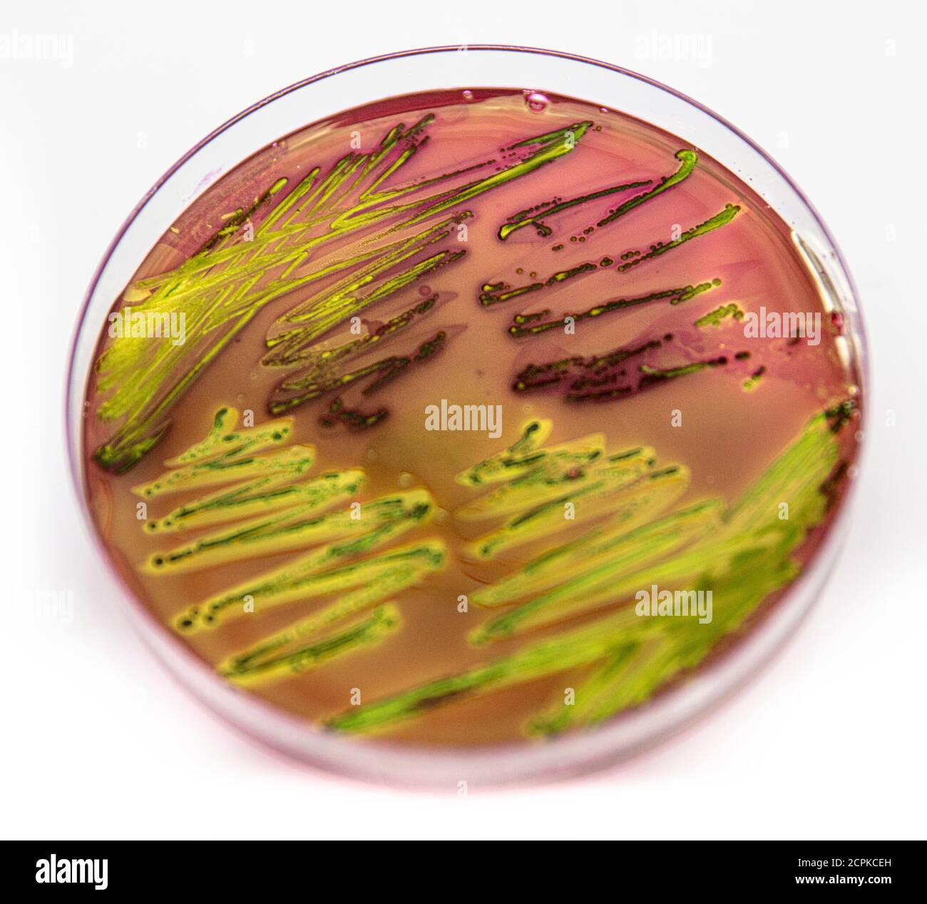 Metallic green sheen characteristic colonies of Escherichia coli on Eosin Methylene Blue Aar (EMB) in close up. Stock Photo