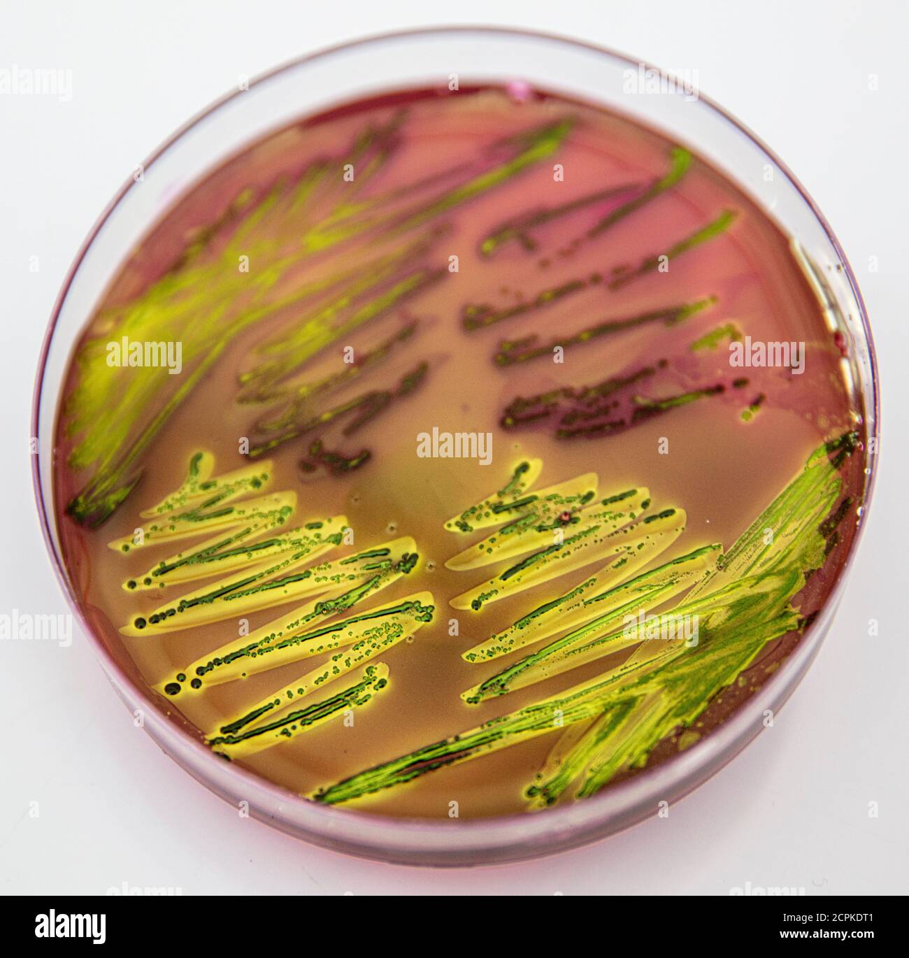 Metallic green sheen characteristic colonies of Escherichia coli on Eosin Methylene Blue Aar (EMB) in close up. Stock Photo