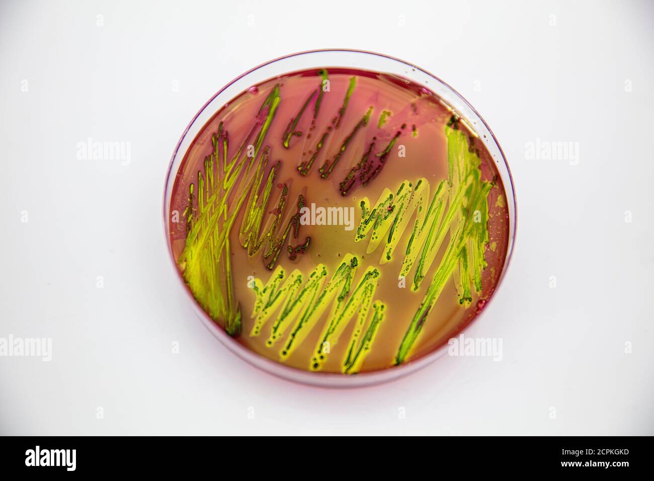 Metallic green sheen characteristic colonies of Escherichia coli on Eosin Methylene Blue Aar (EMB) in close up. Stock Photo