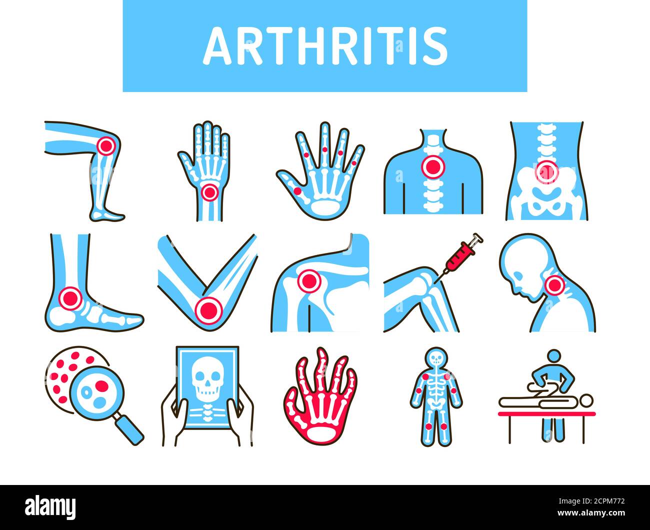 Arthritis human body line color icons set. Inflammation joints. Signs