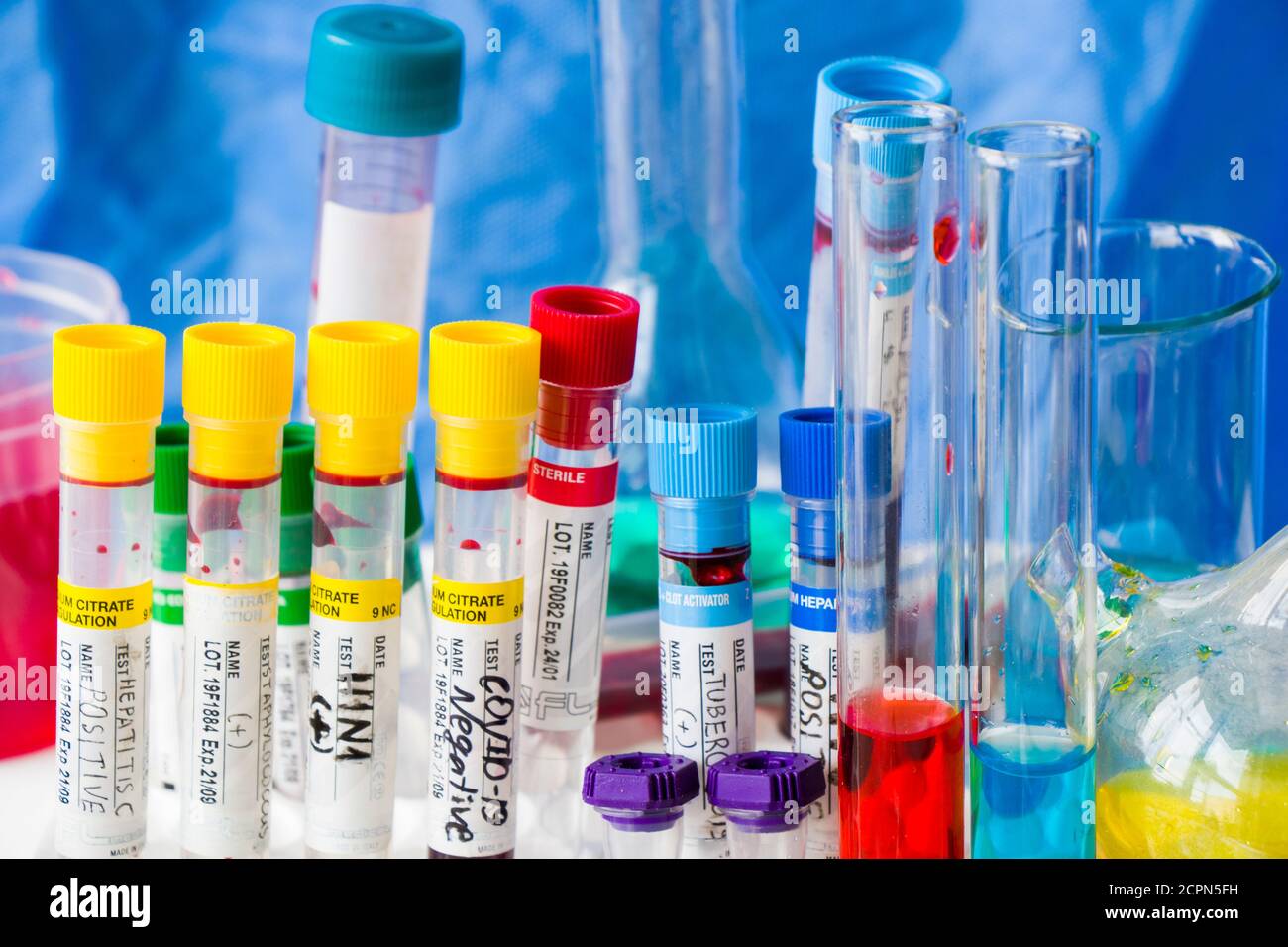 Lab Test Elements Laboratory table, blood test tube samples and glassware with liquid ...