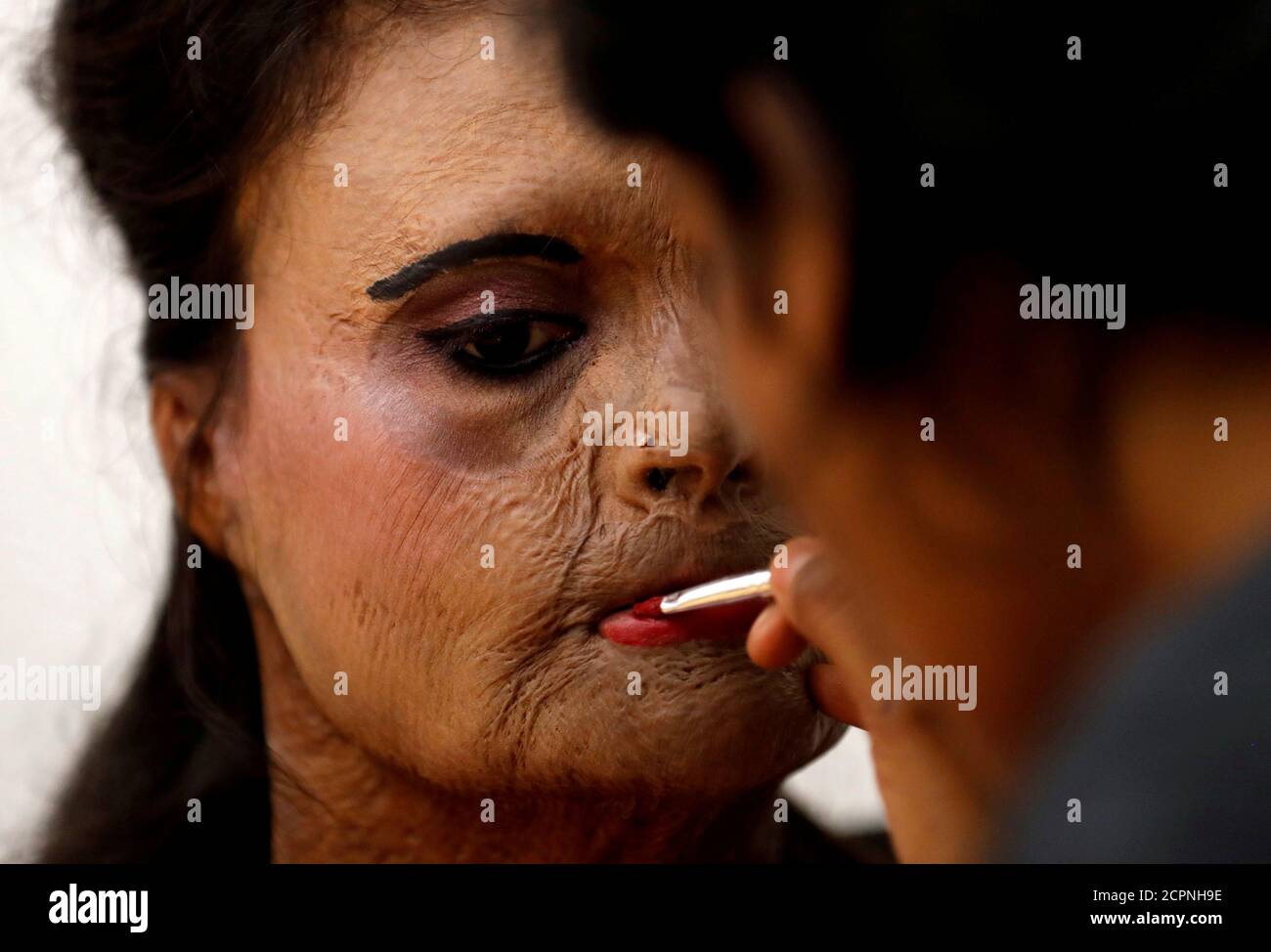 An acid attack survivor has her makeup done backstage prior to a fashion  show to mark International Women's Day in Thane on the outskirts of Mumbai,  India, March 7, 2018. REUTERS/Danish Siddiqui