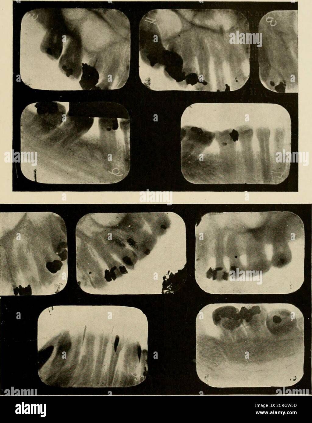 Radiographicexamination hires stock photography and images Alamy
