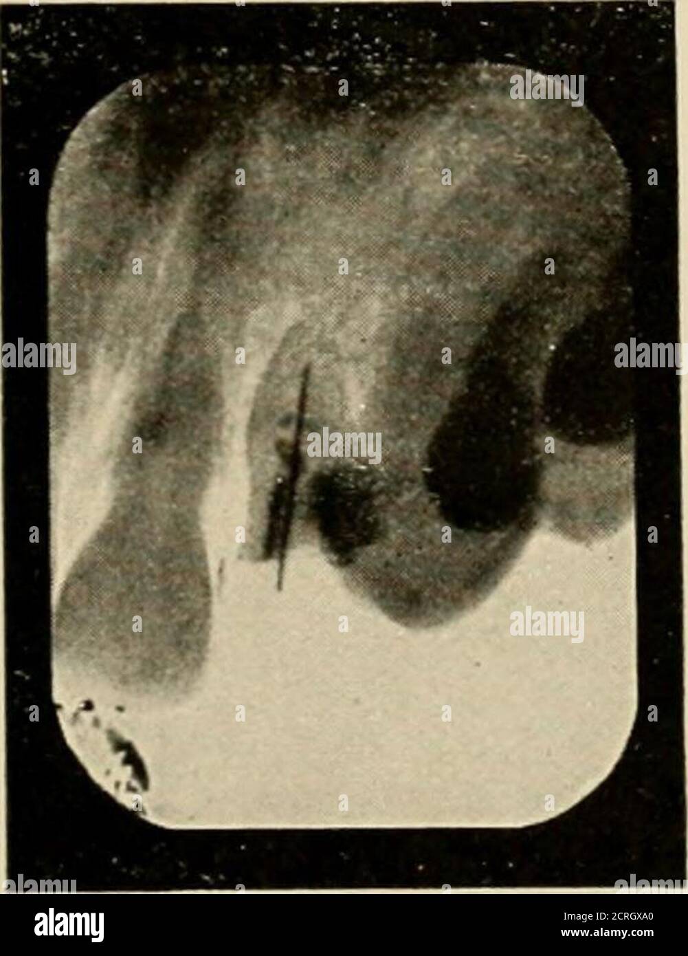 . Elementary and dental radiography / by Howard Riley Raper . Fig. 431