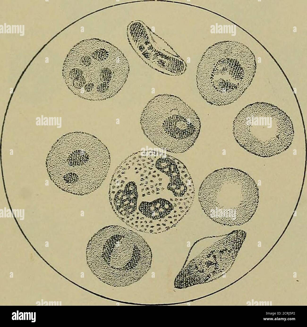 Flushed skin hires stock photography and images Alamy