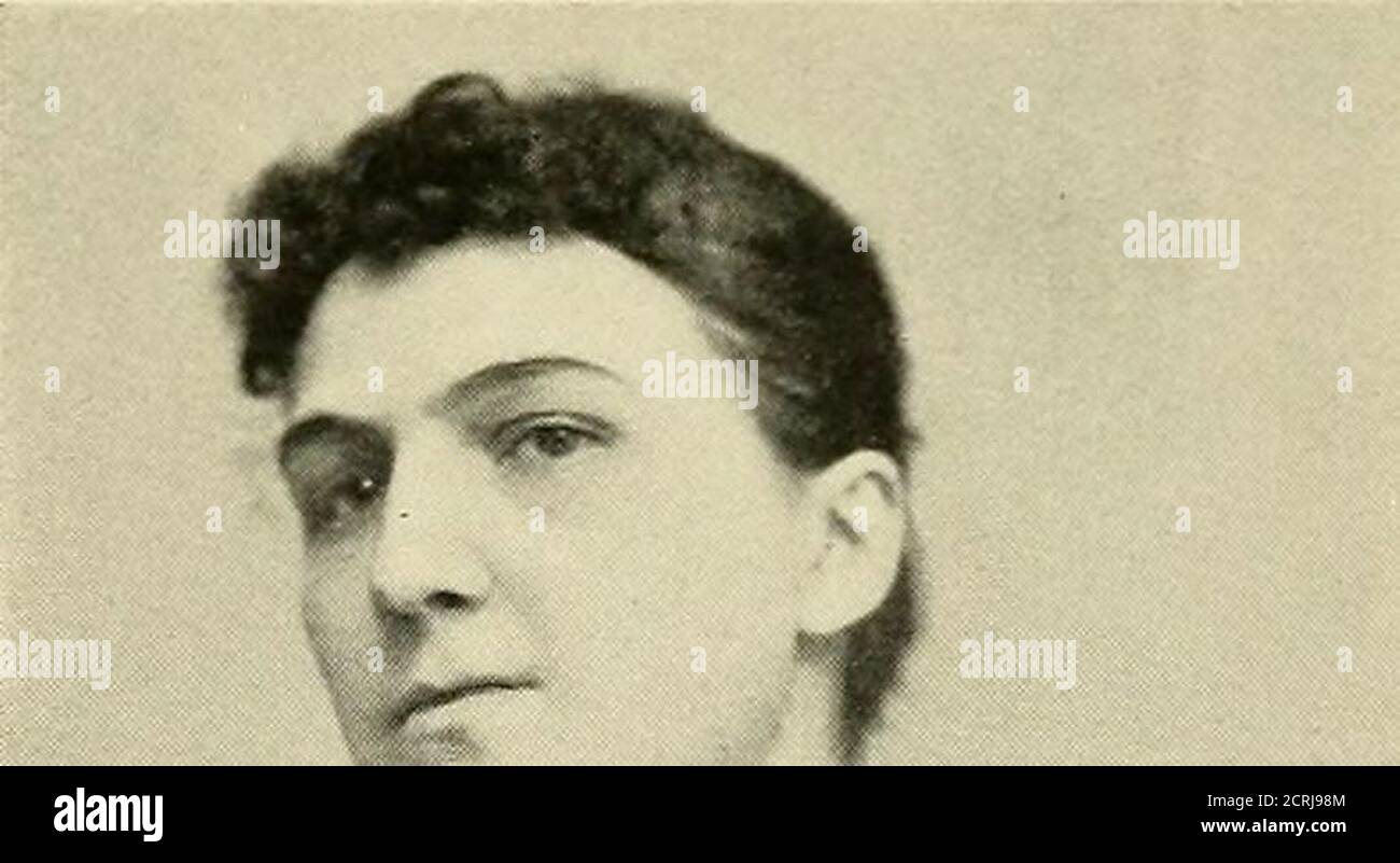 . Röntgen ray diagnosis and therapy . Fig. 308.—Sarcoma Originating ...