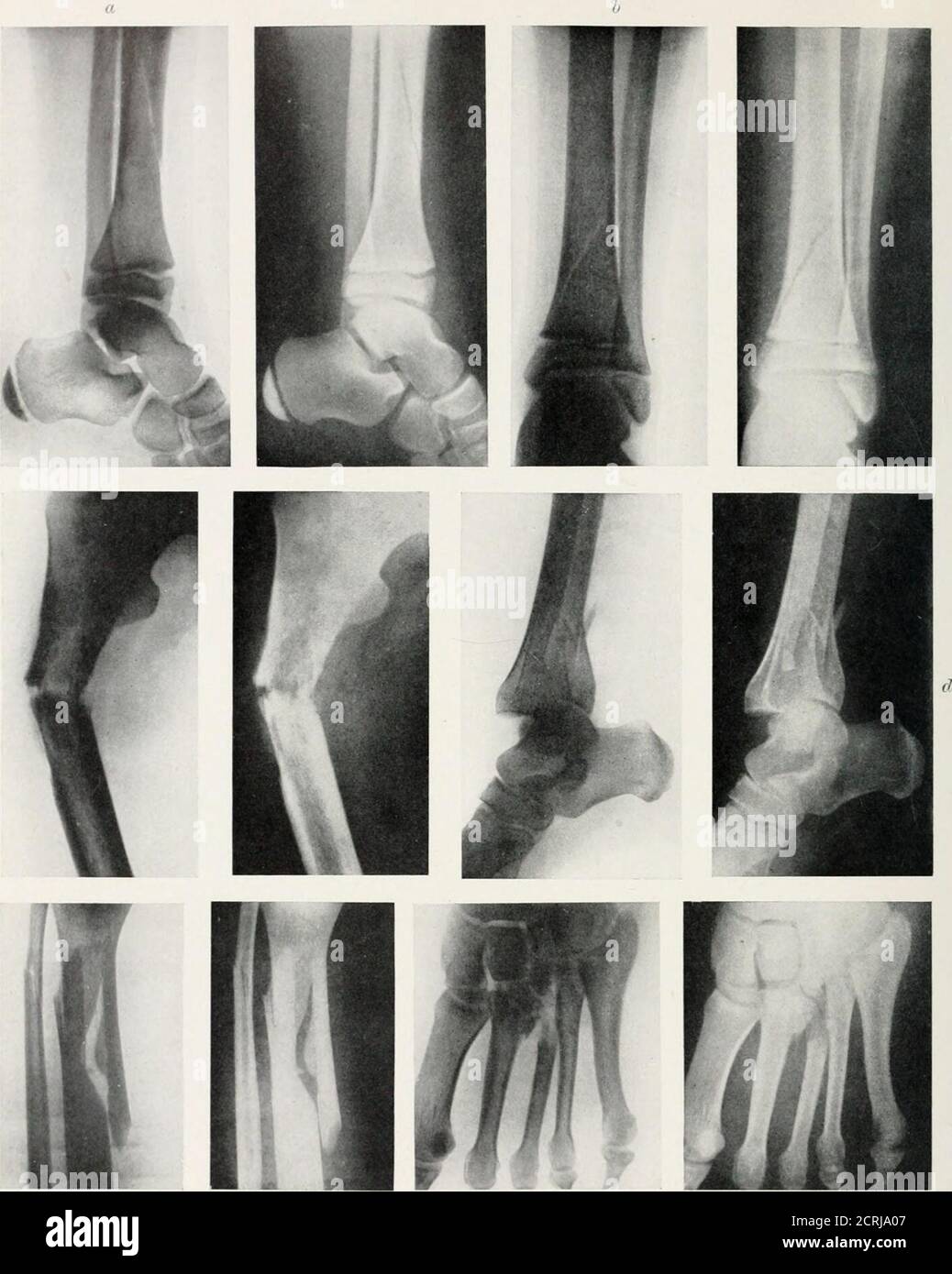. Radiography, X-ray therapeutics and radium therapy . PLATE XX ...