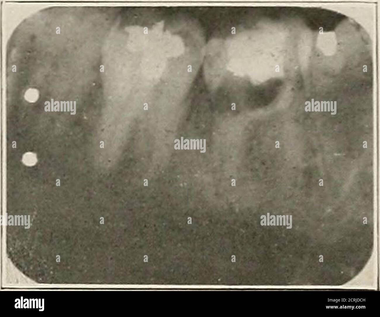 . Interpretation of dental and maxillary roentgenograms . Fig. IS Fig