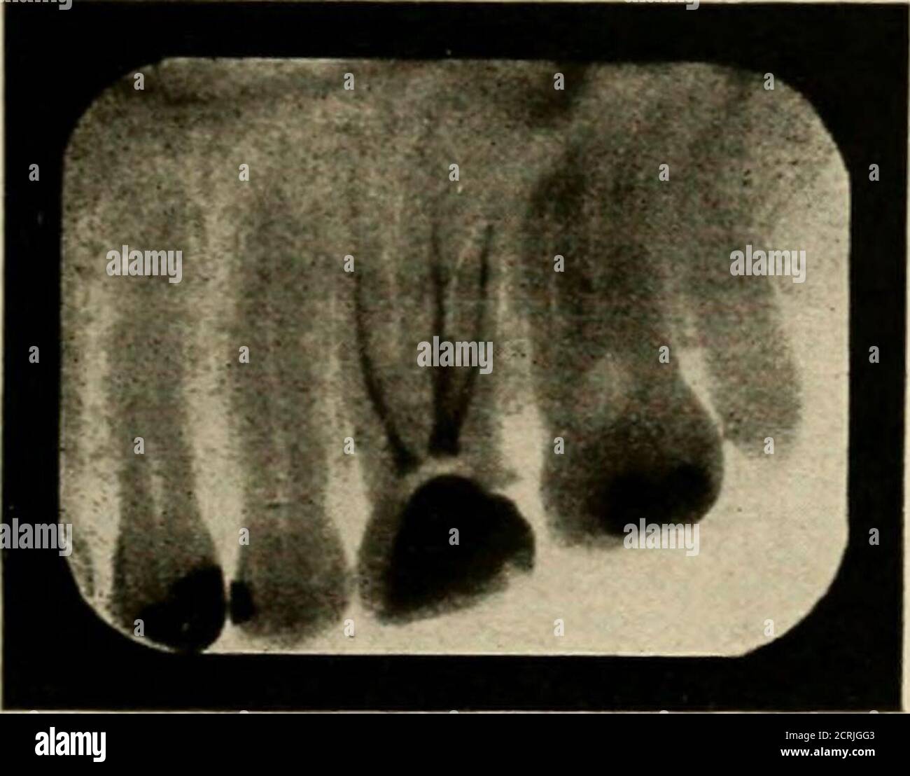 First radiograph hi-res stock photography and images - Alamy