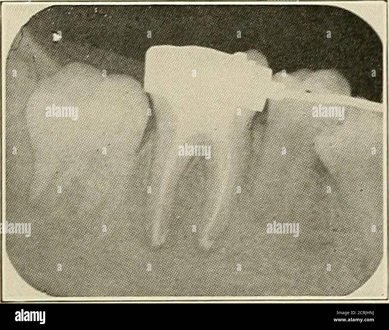 Examples Of Dental Radiography High Resolution Stock Photography and