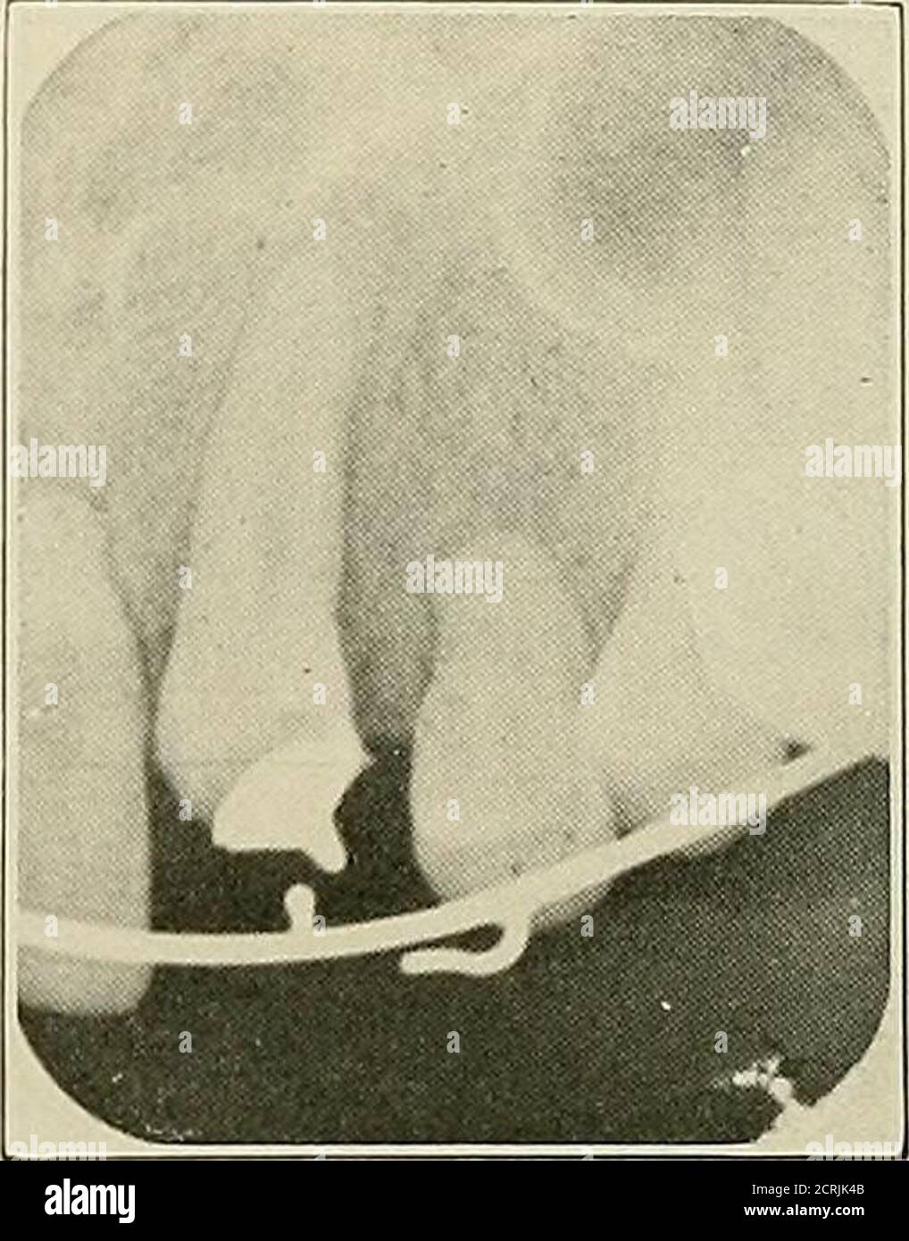 . Dental and oral radiography; a textbook for students and