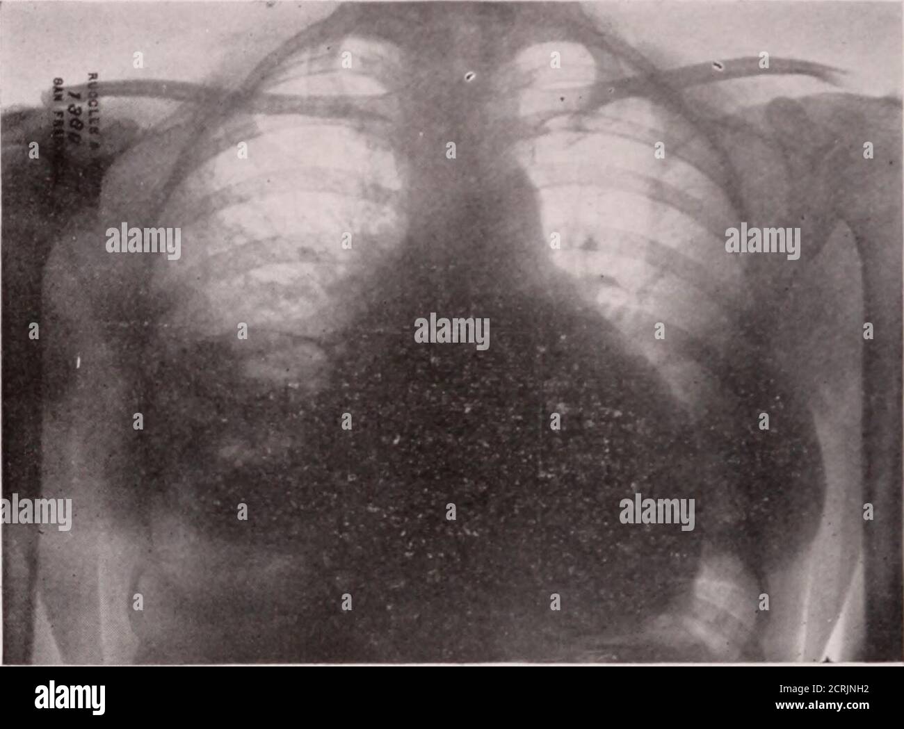 Homogeneous density hi-res stock photography and images - Alamy