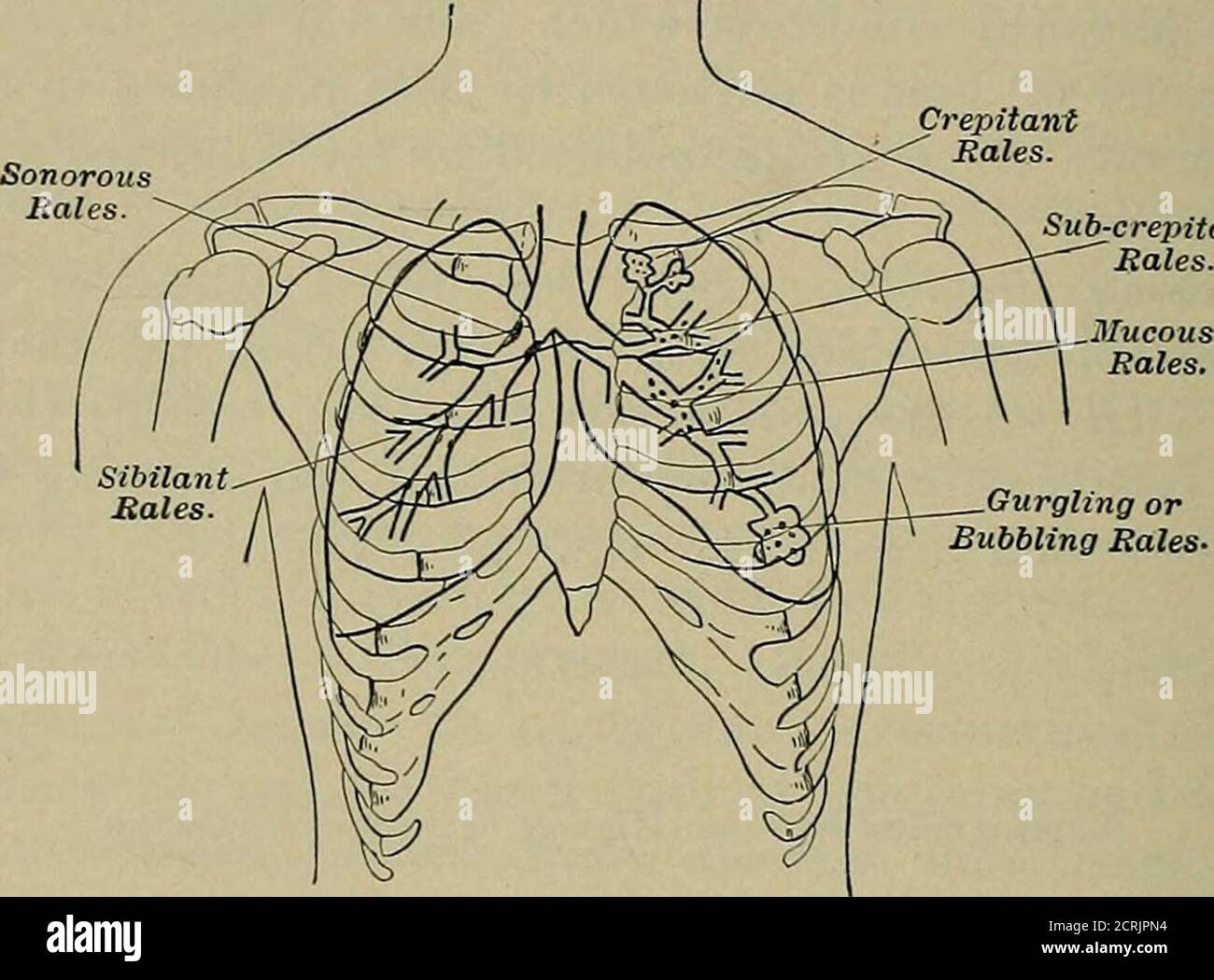 Asthma bronchial tubes hires stock photography and images Alamy