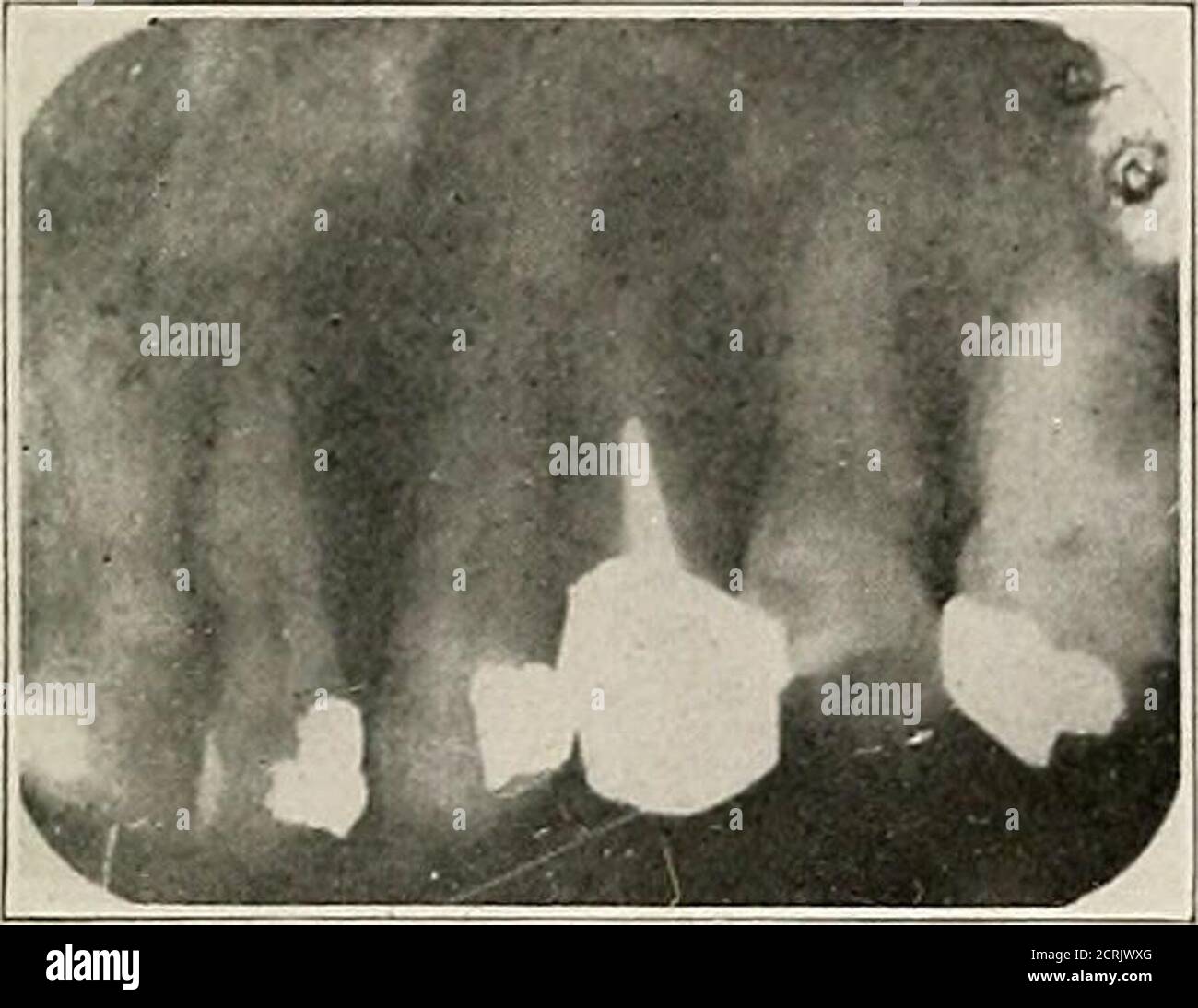. Interpretation of dental and maxillary roentgenograms . Fig. 1( Fig