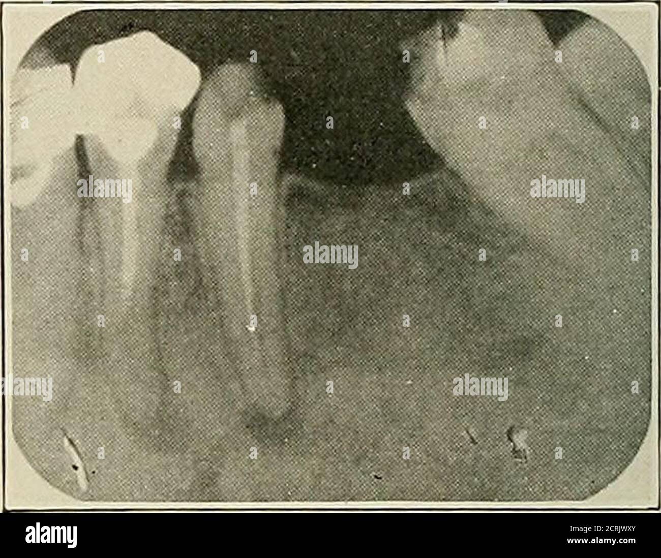 . Dental and oral radiography; a textbook for students and