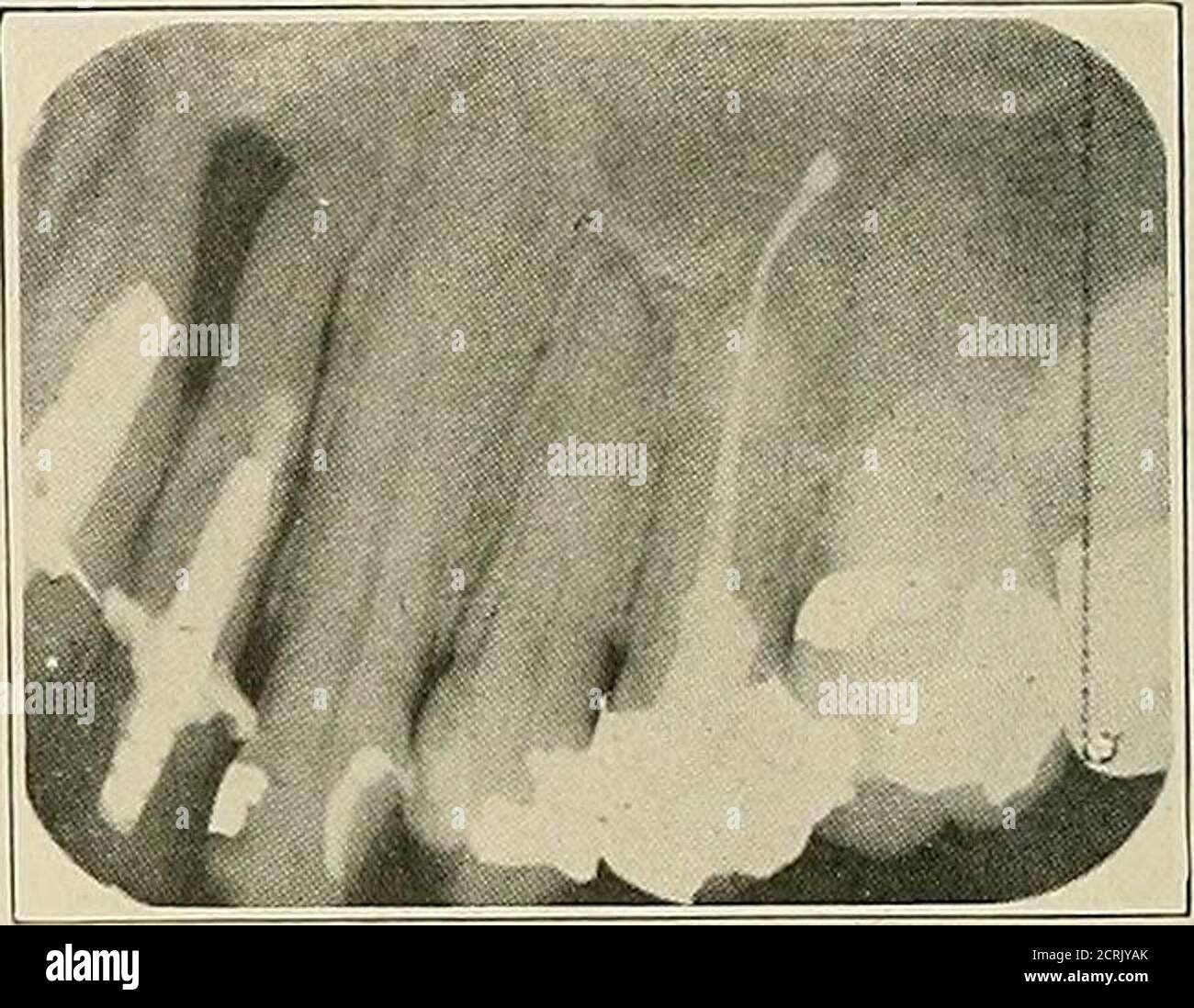 . Dental and oral radiography; a textbook for students and