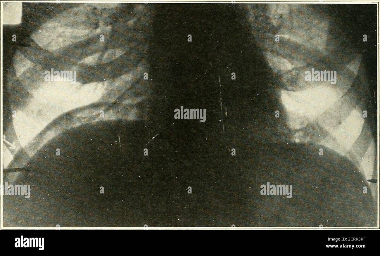 . Roentgen interpretation; a manual for students and practitioners ...