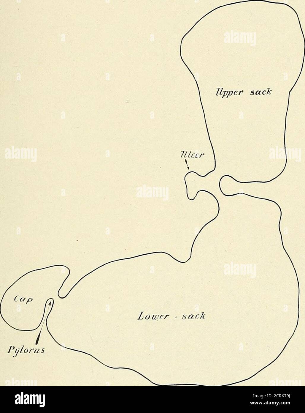. Roentgen interpretation; a manual for students and practitioners . doAvnward (ptosis) is of no importance unless accompanied by asix-hour residue or definite clinical evidence of abnormal function.It may be shifted downward and to the left by enlargement of theliver or tumors in the right upper cpjadrant. In i)yloric obstructionwhere dilatation has occurred the stomach shadow often appearsfarther to the right than normal, but this is due to dilatation of theantrum and is not a true displacement of the entire stomach. Changes in Outline.—Changes in outline occur (1) as a result ofspasm. This Stock Photo